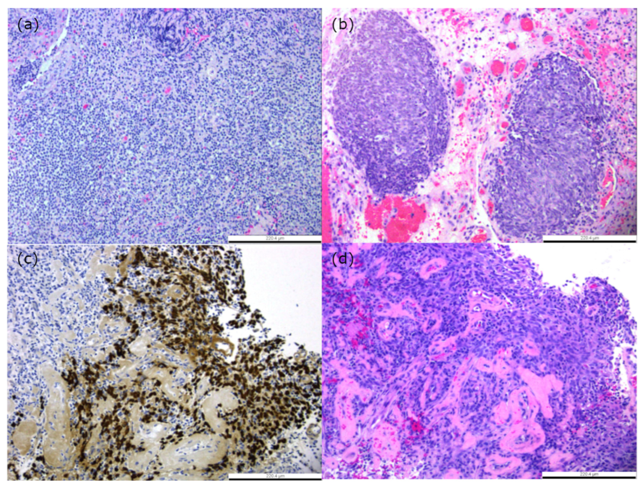 Cancers 16 00918 g001 Cancers 16 00918 g001