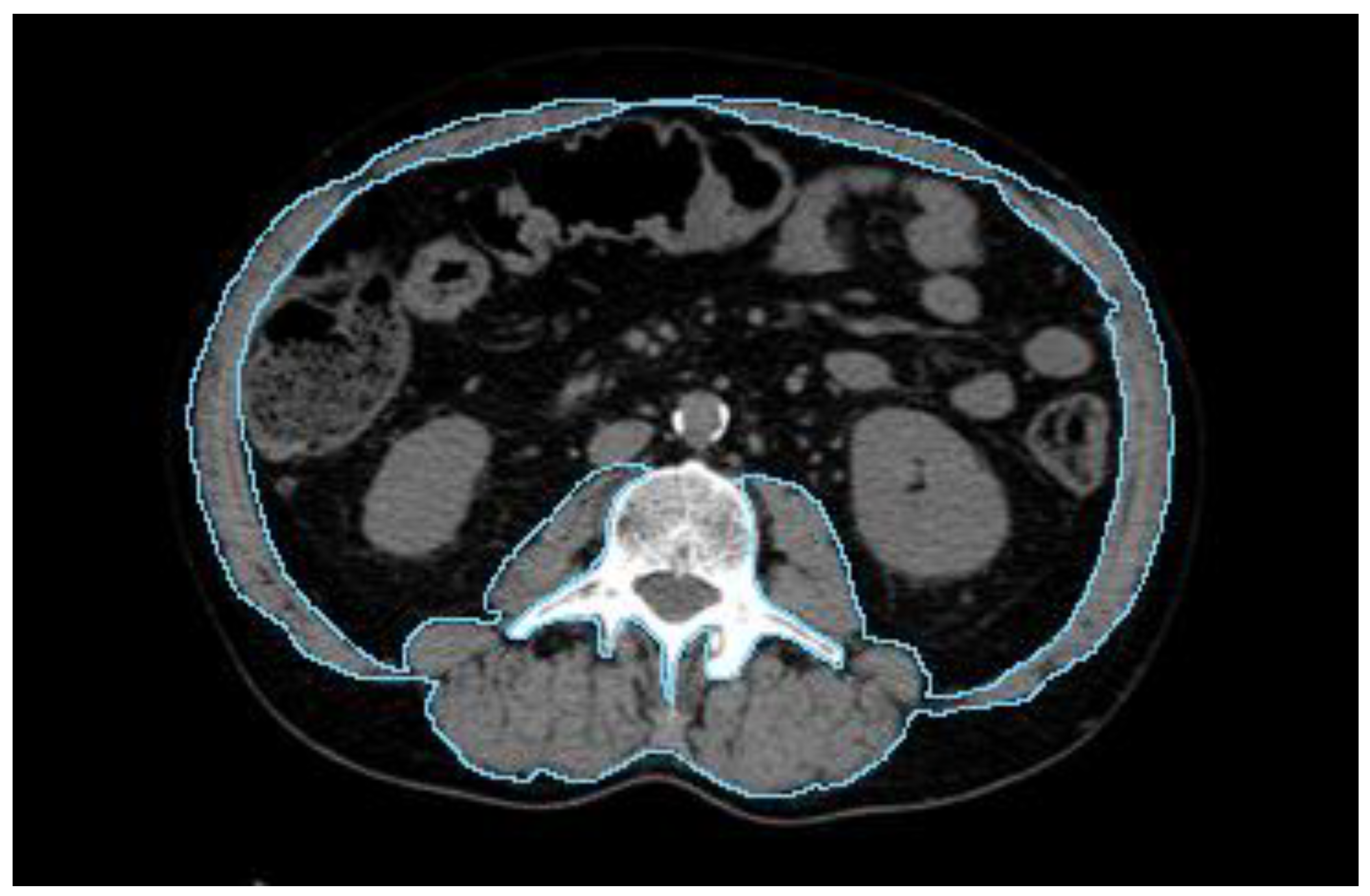 Cancers 16 00929 g001