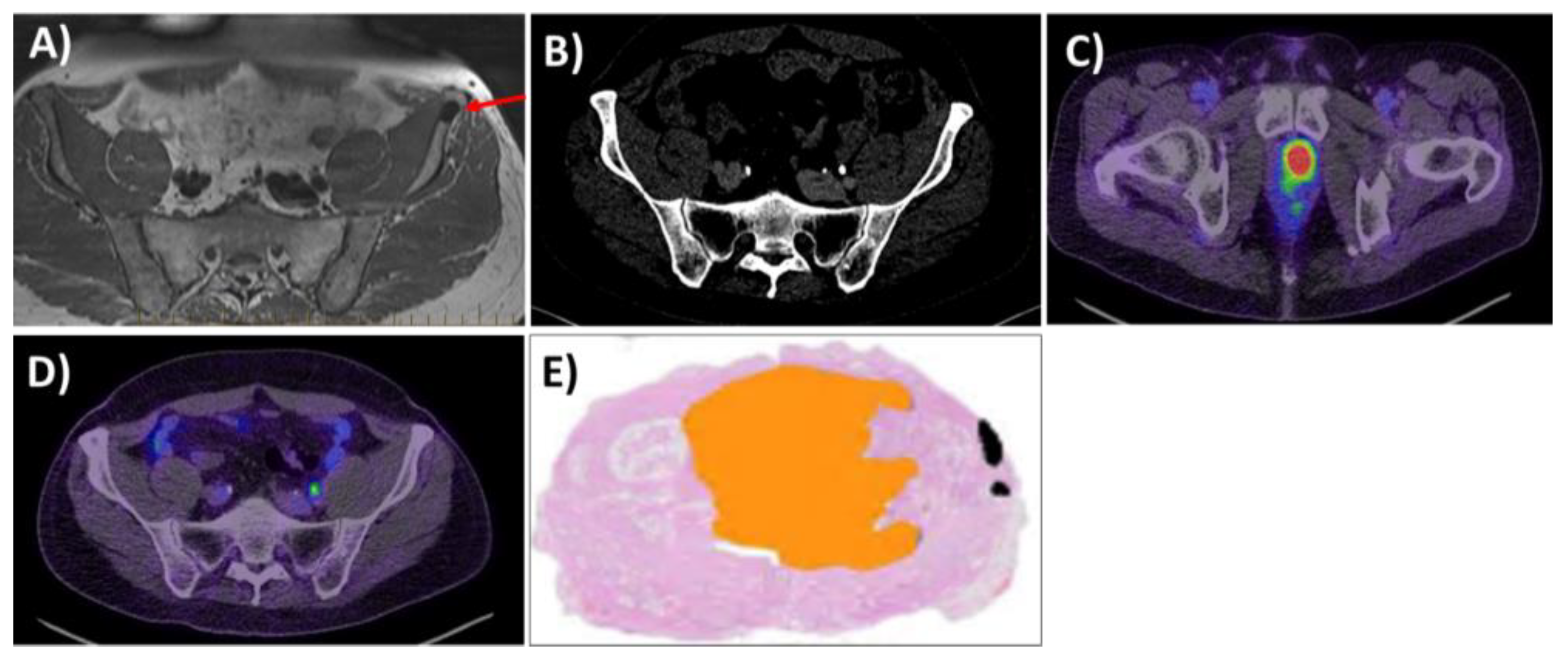 Cancers 16 00939 g001