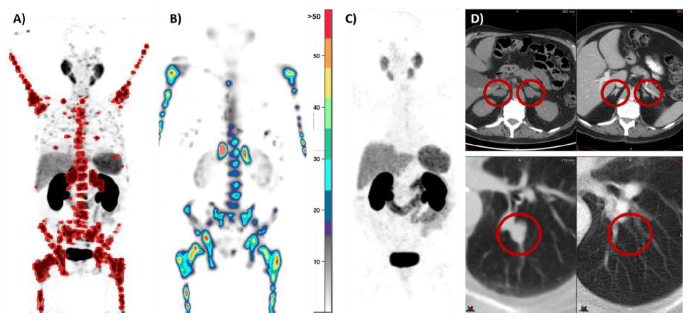Cancers 16 00939 g003