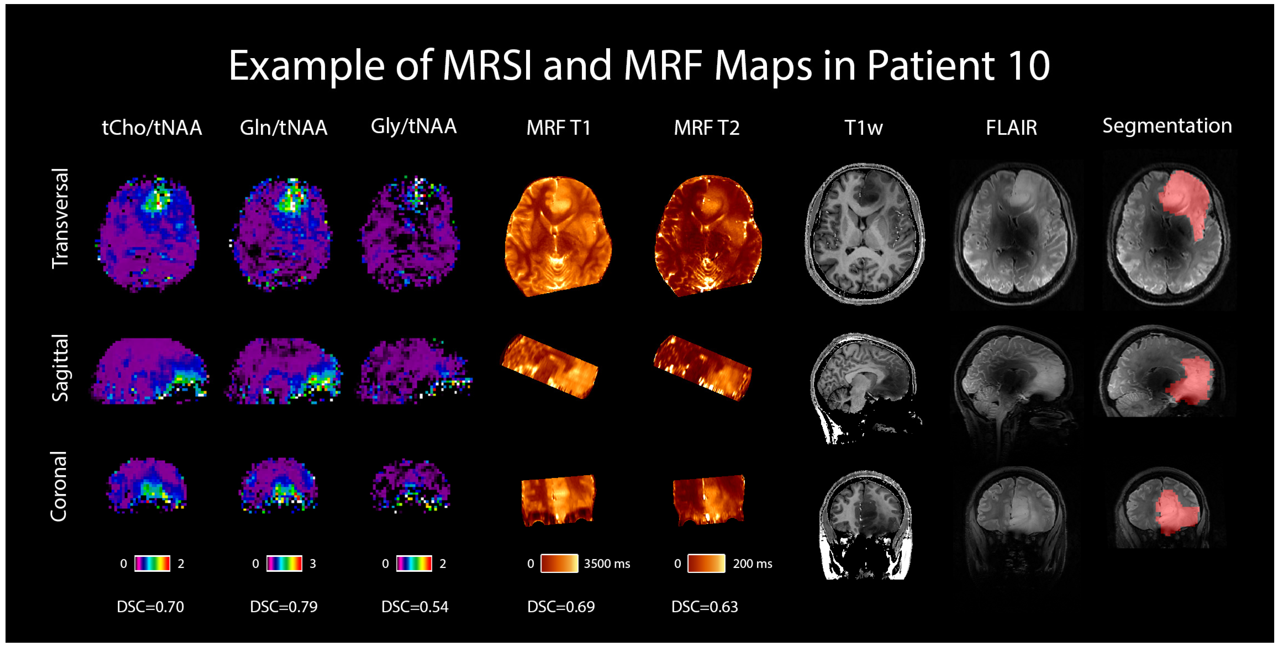 Cancers 16 00943 g006