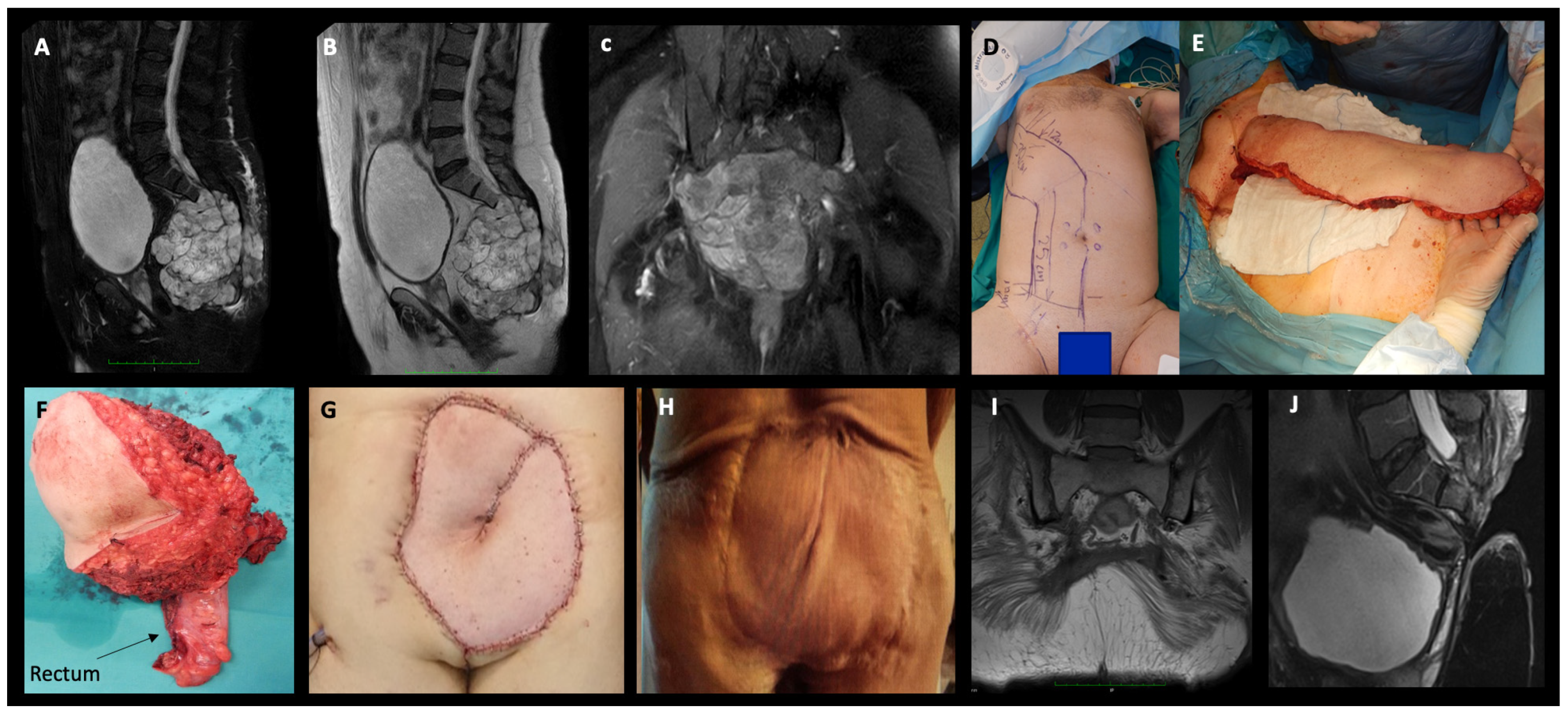 Cancers 16 00973 g002