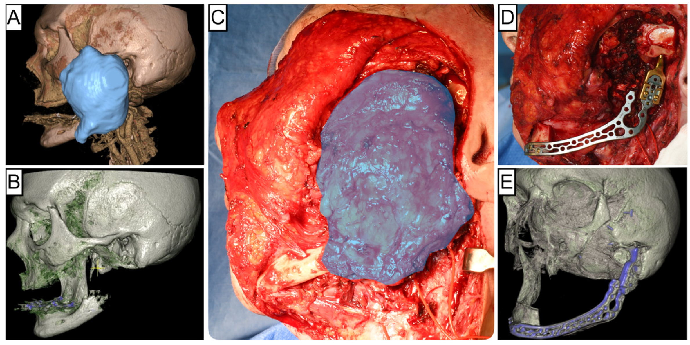 Cancers 16 00974 g001
