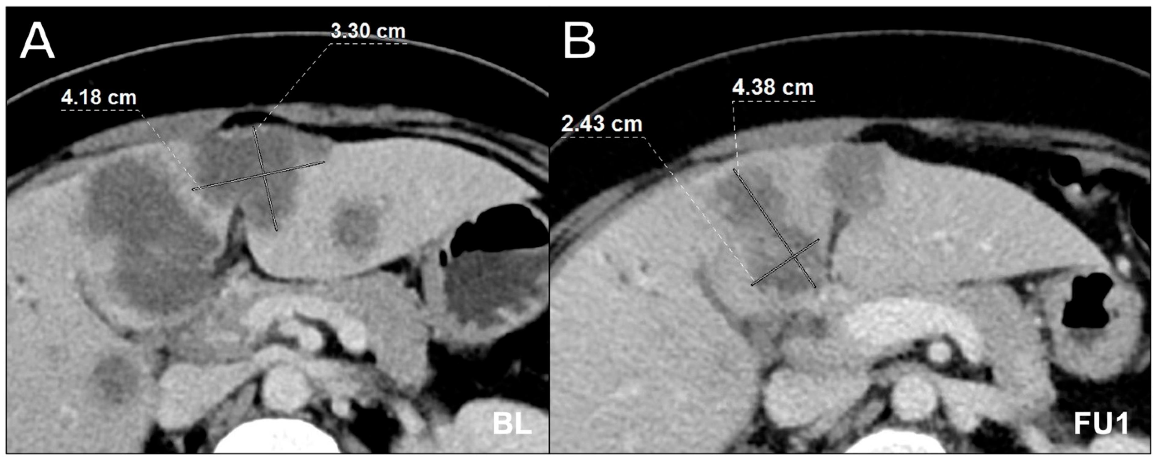 Cancers 16 00993 g003