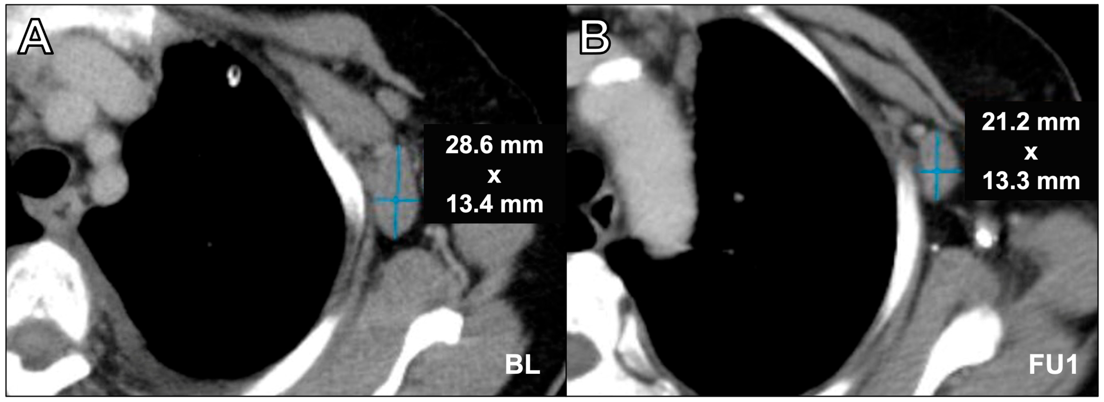 Cancers 16 00993 g004