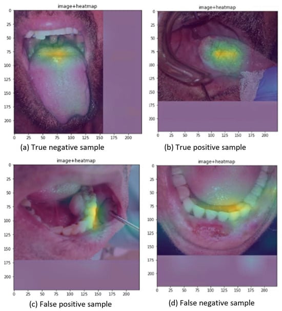 Cancers 16 01019 g0a2