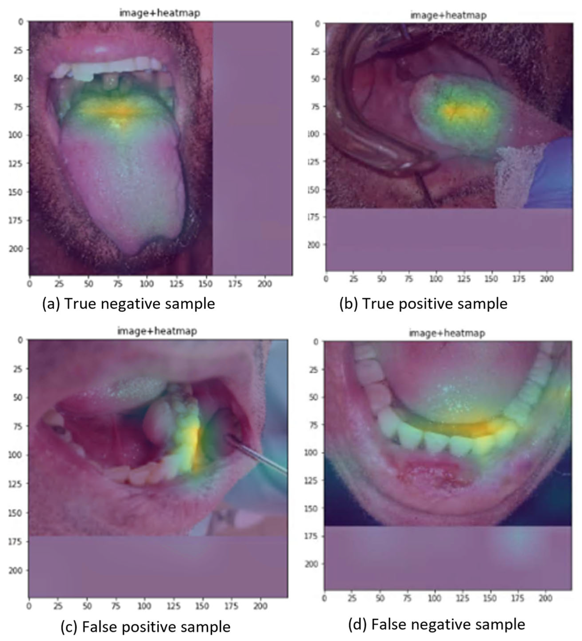 Cancers 16 01019 g0a2