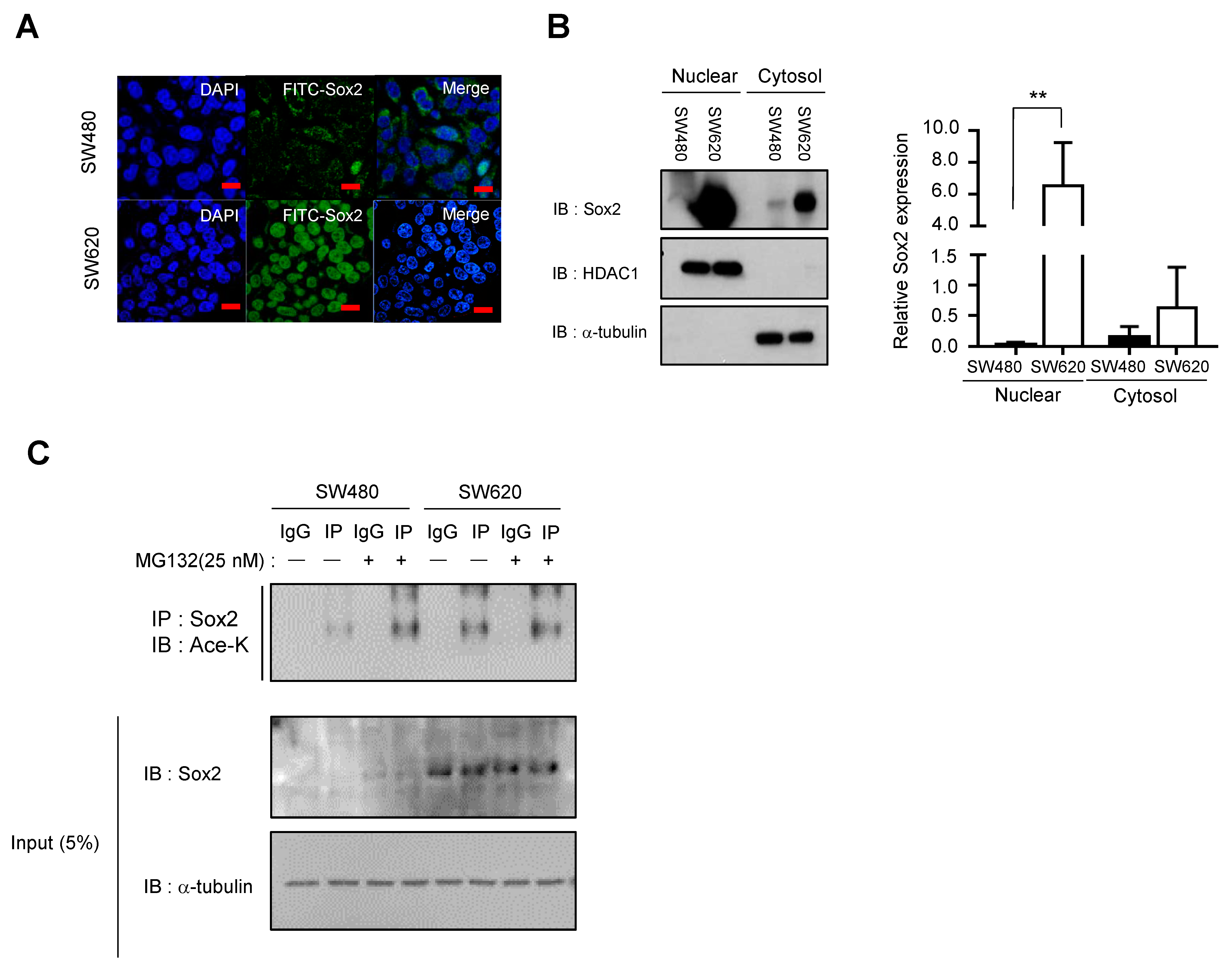 A Comprehensive Understanding of Post-Translational Modification of ...