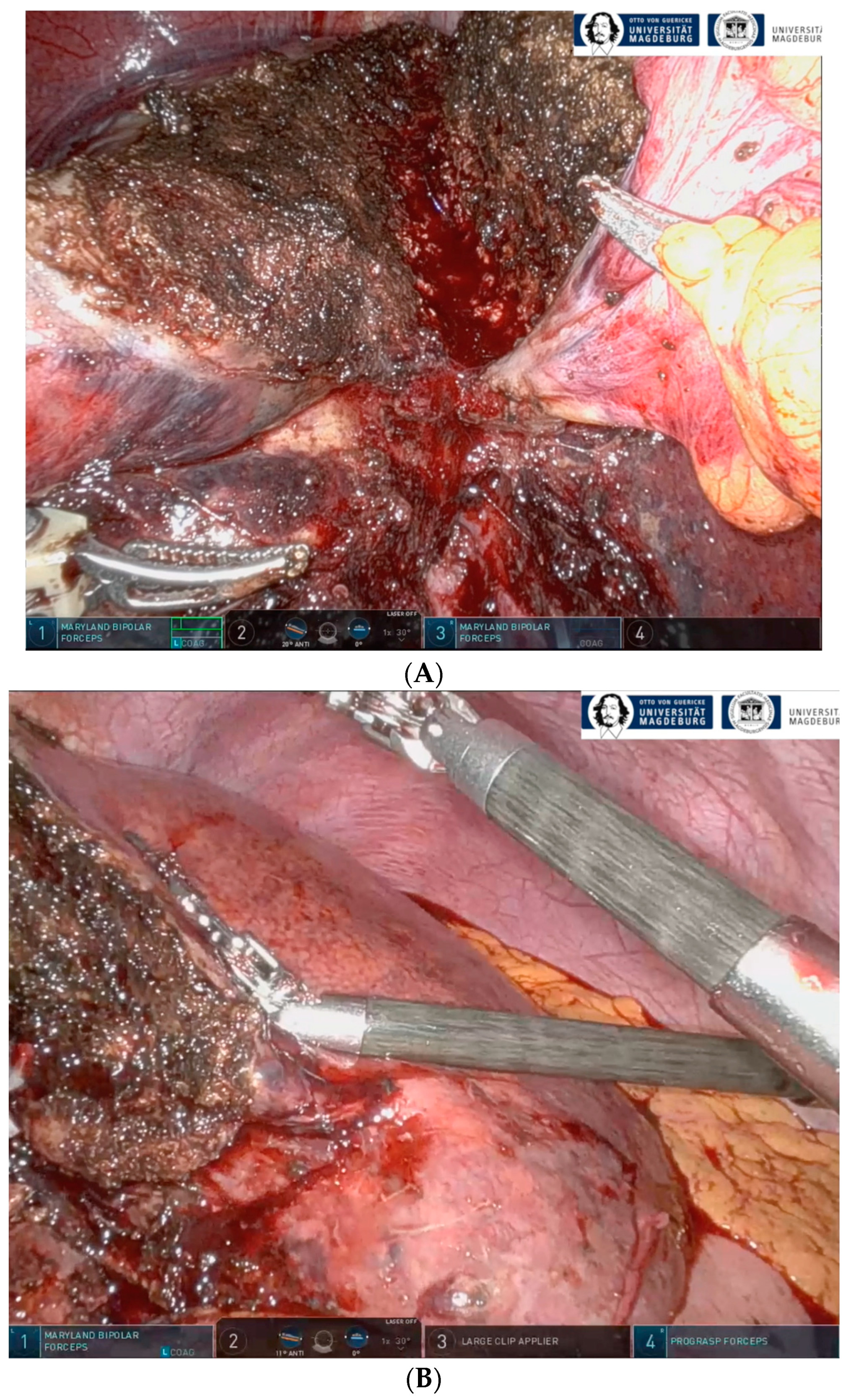 Cancers 16 01070 g001