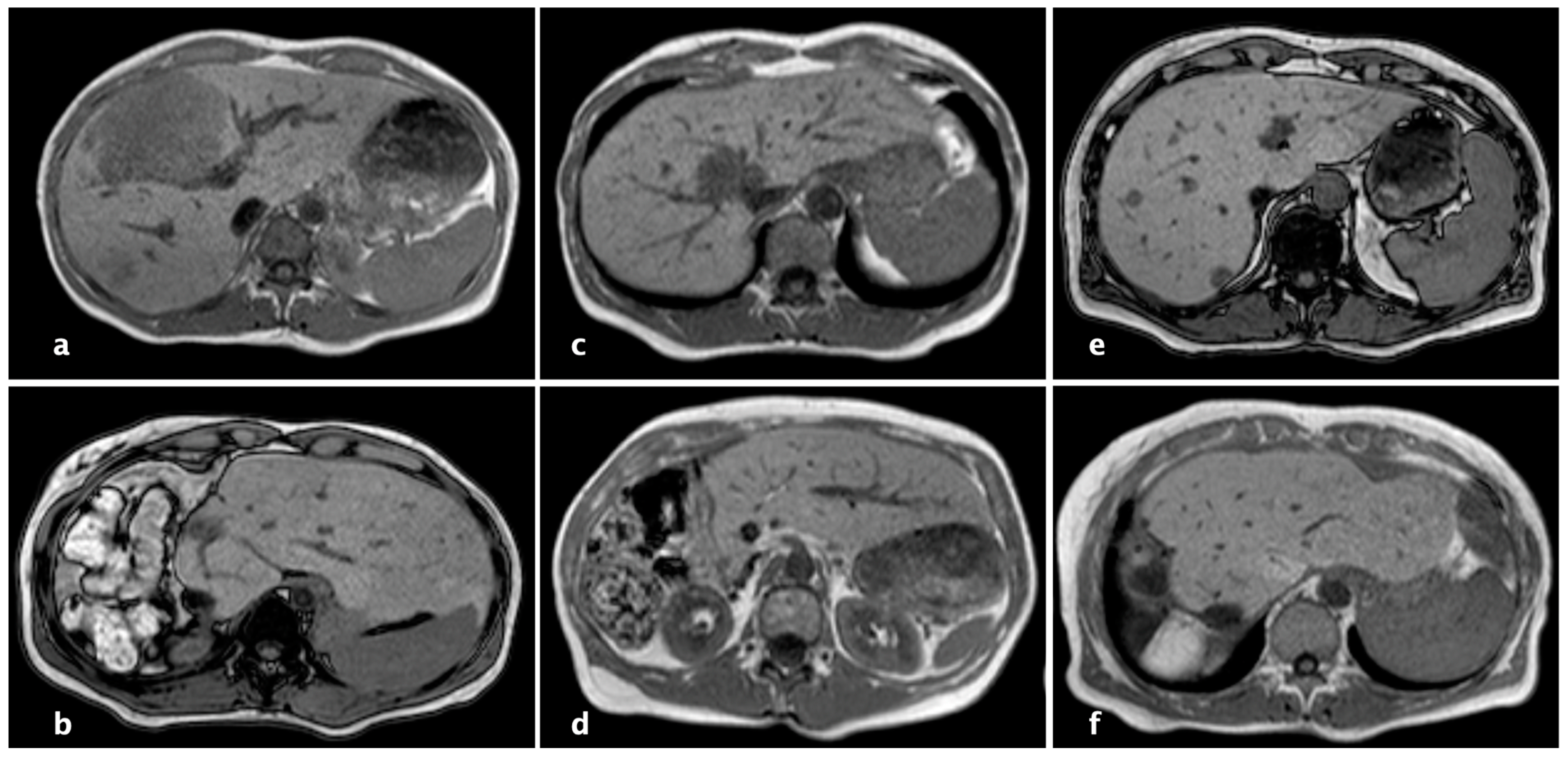Cancers 16 01070 g003