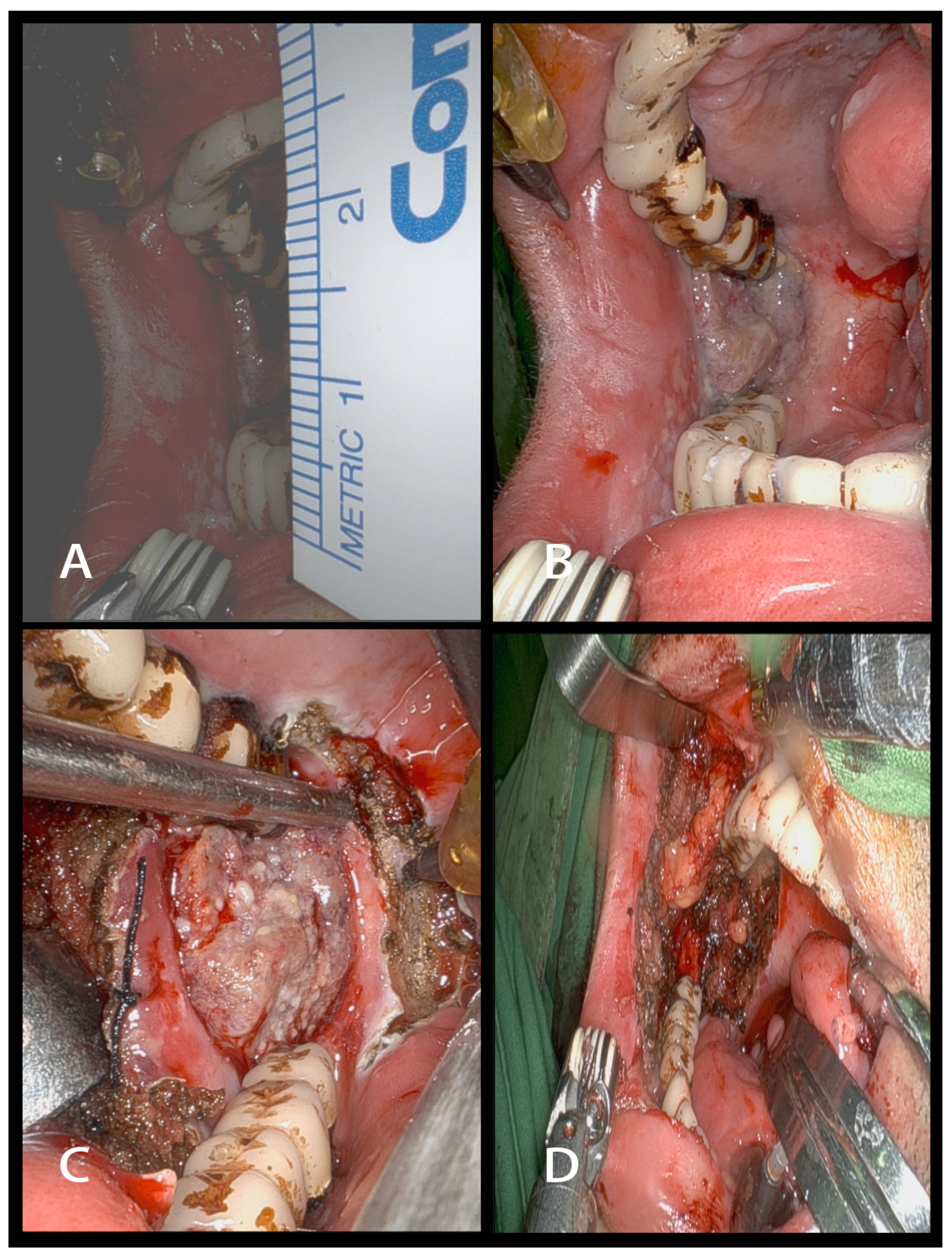 Cancers 16 01111 g001