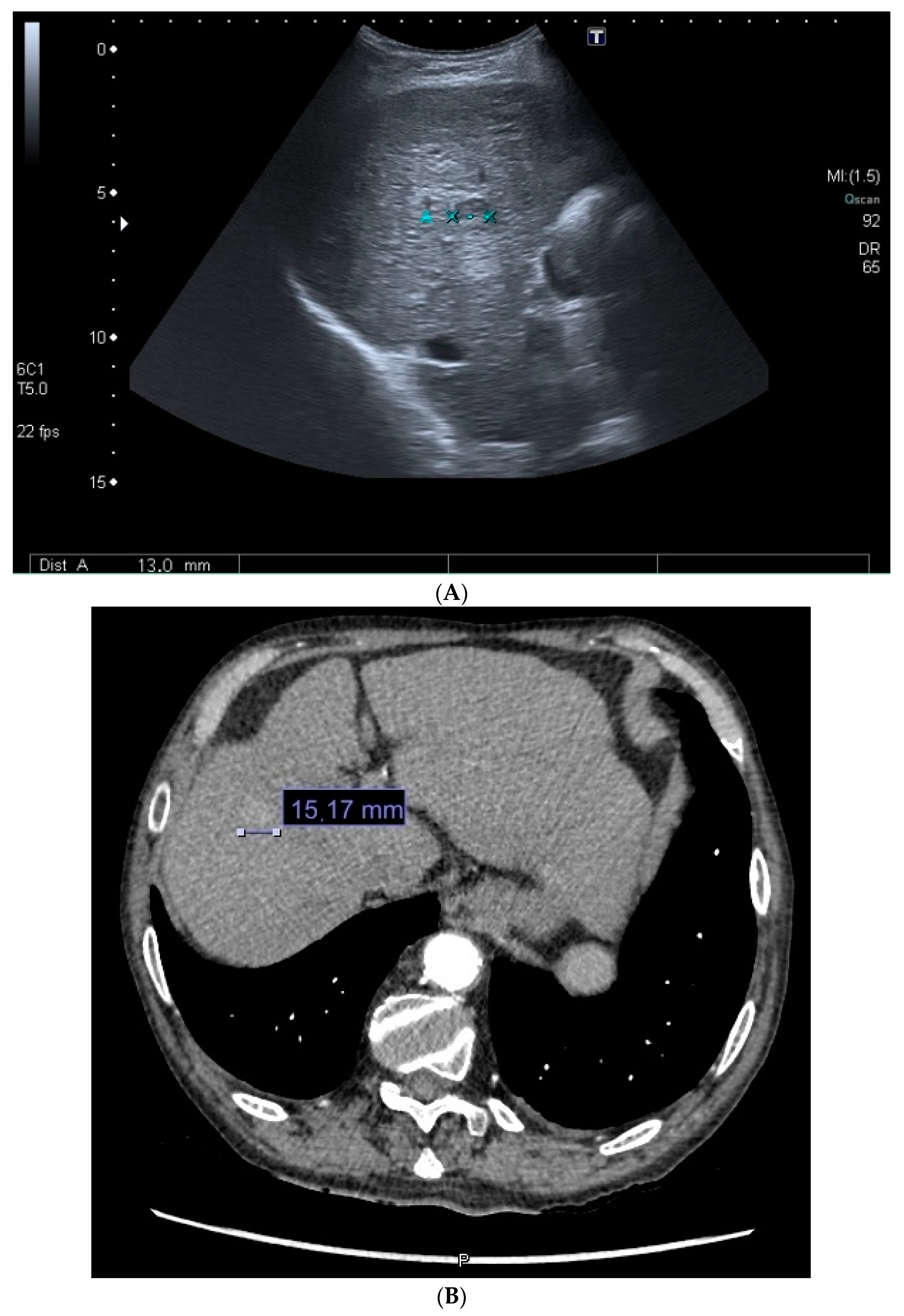 Cancers 16 01114 g005a