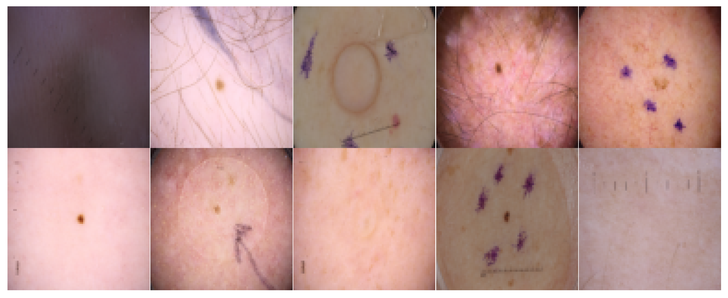 Cancers 16 01120 g004