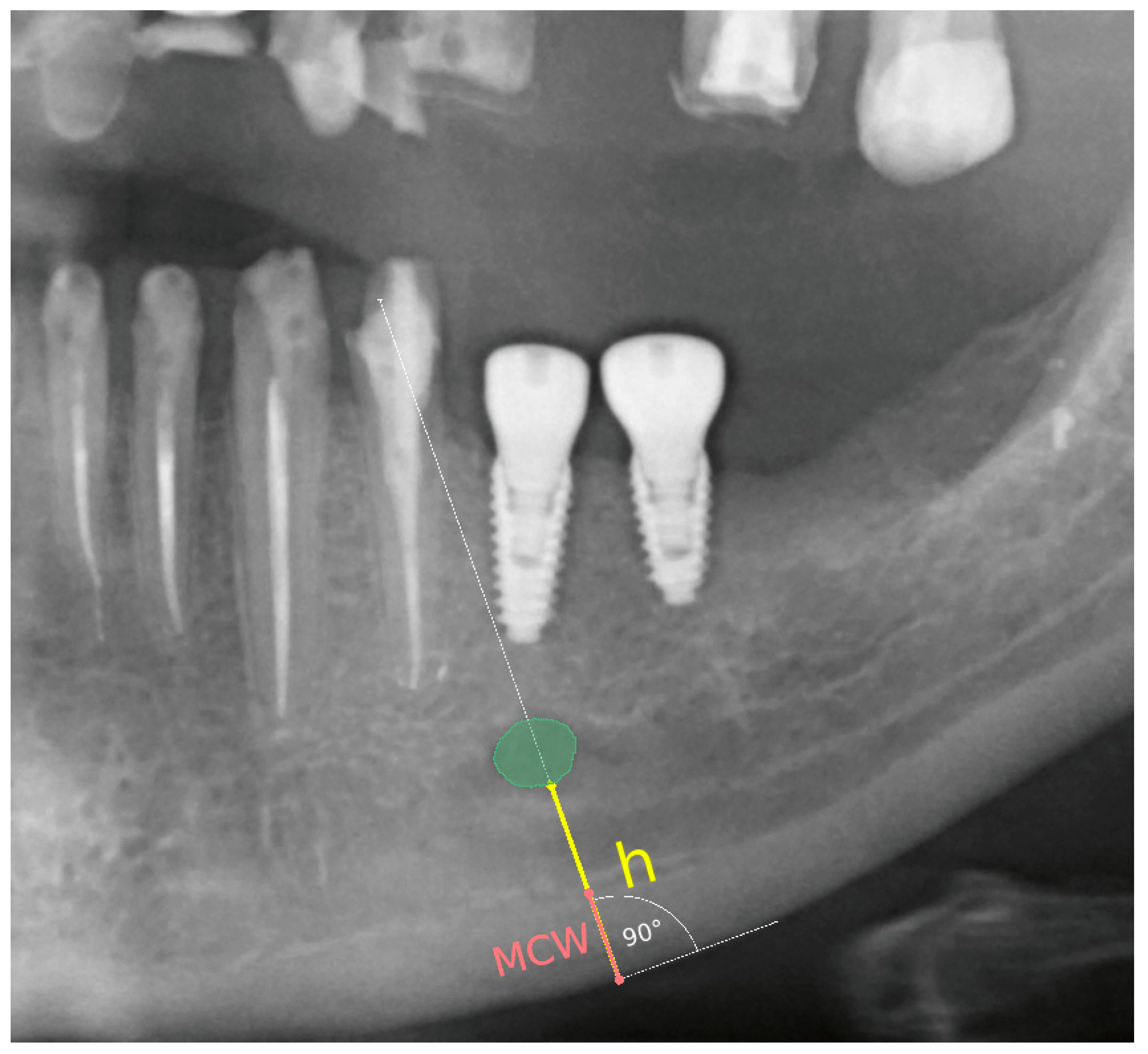 Cancers 16 01124 g002