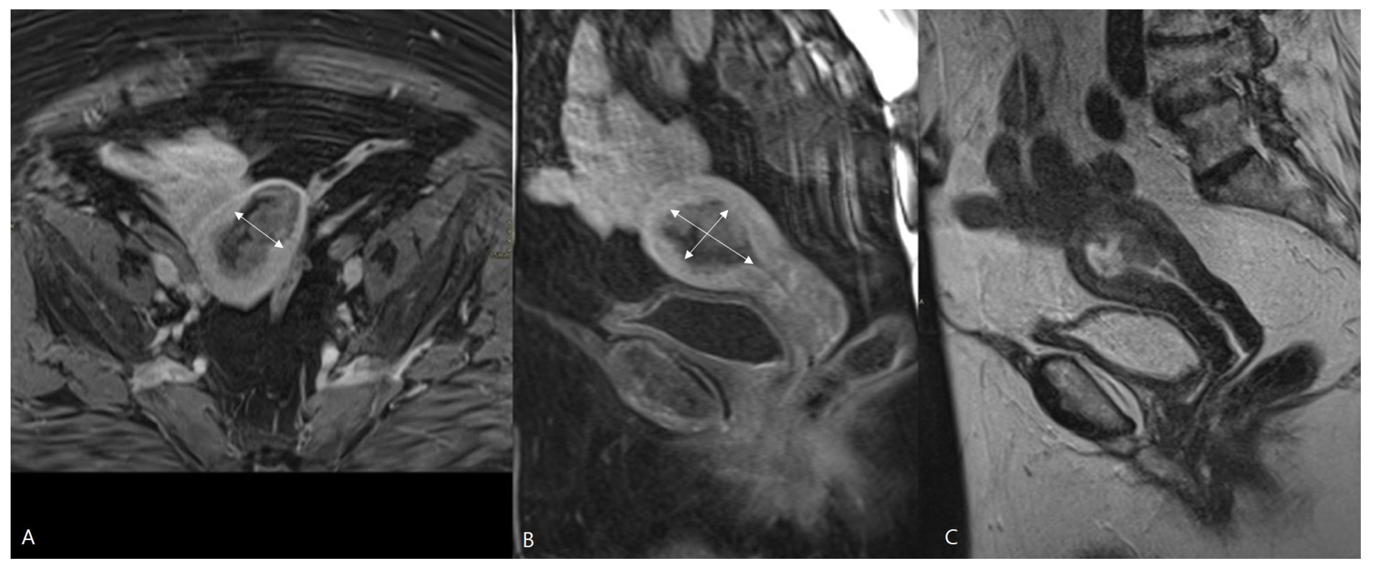 Cancers 16 01142 g002