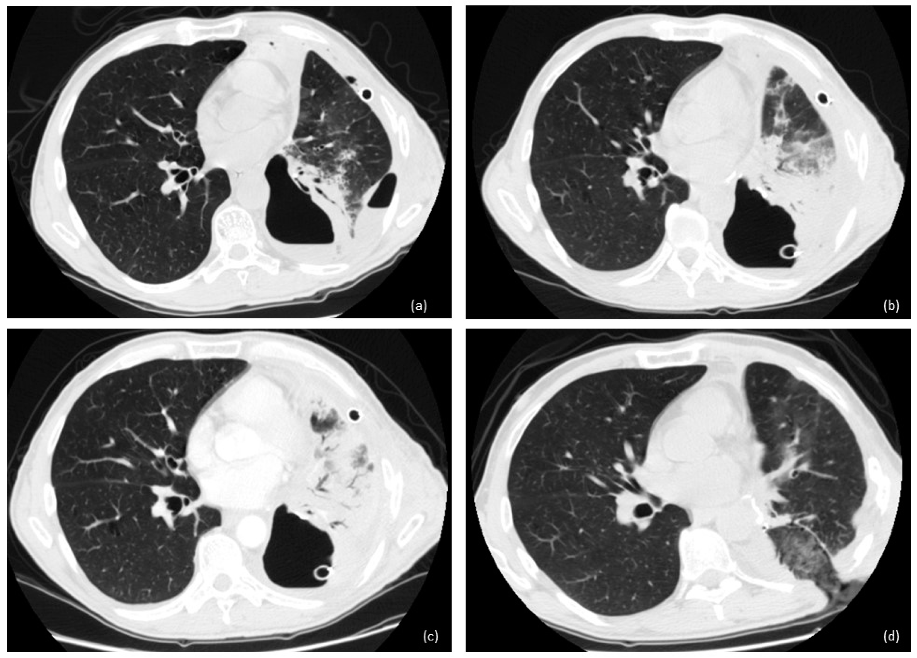 Cancers 16 01146 g002 Cancers 16 01146 g002