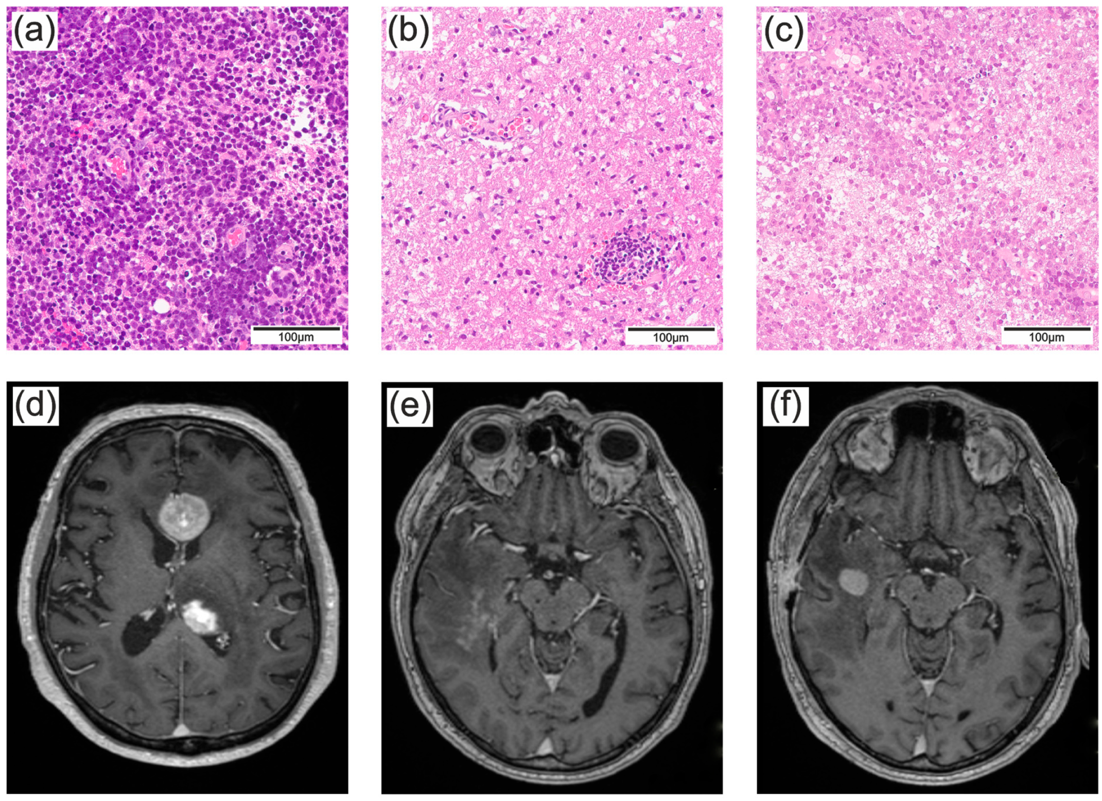 Cancers 16 01157 g001