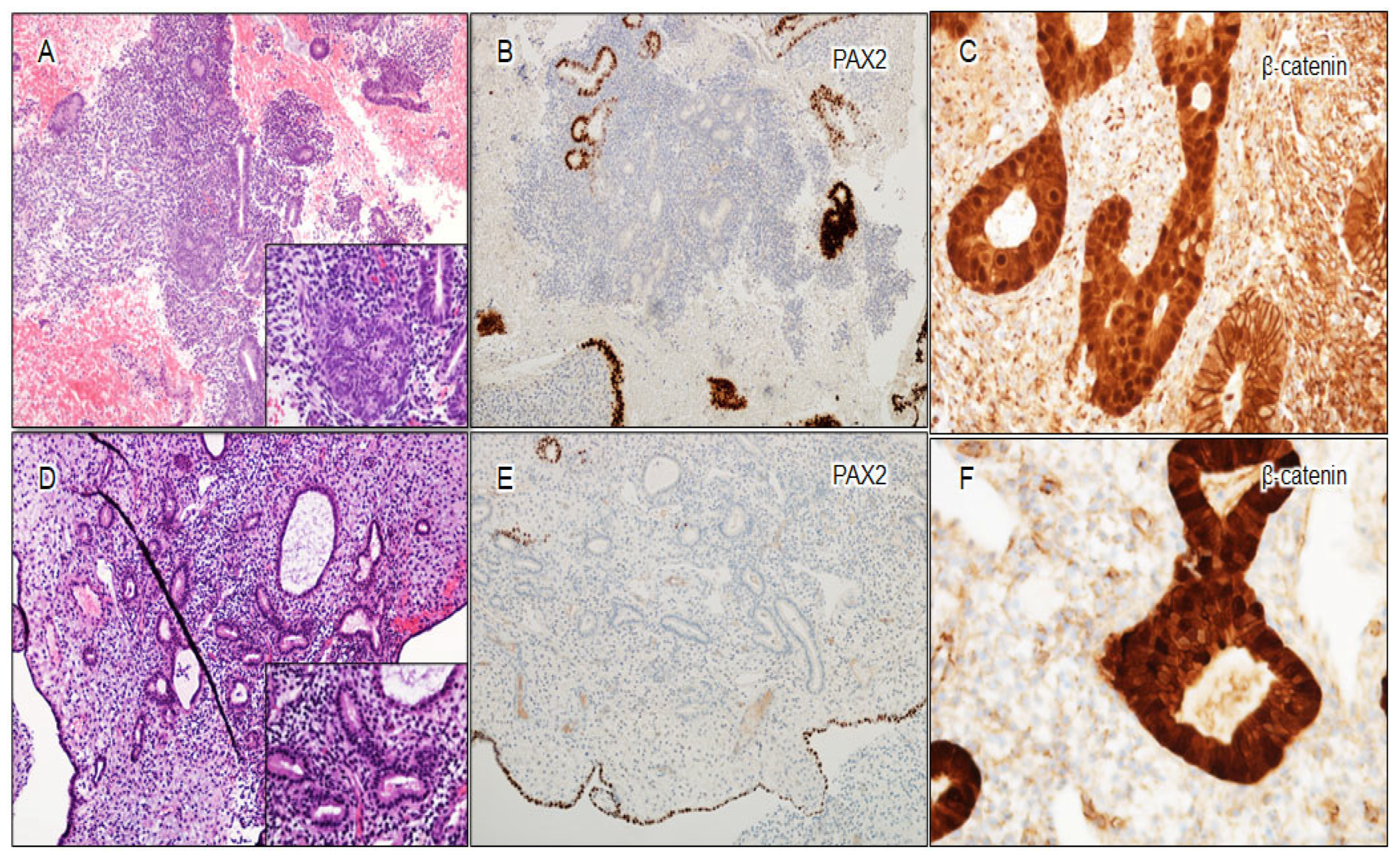 Cancers 16 01159 g005