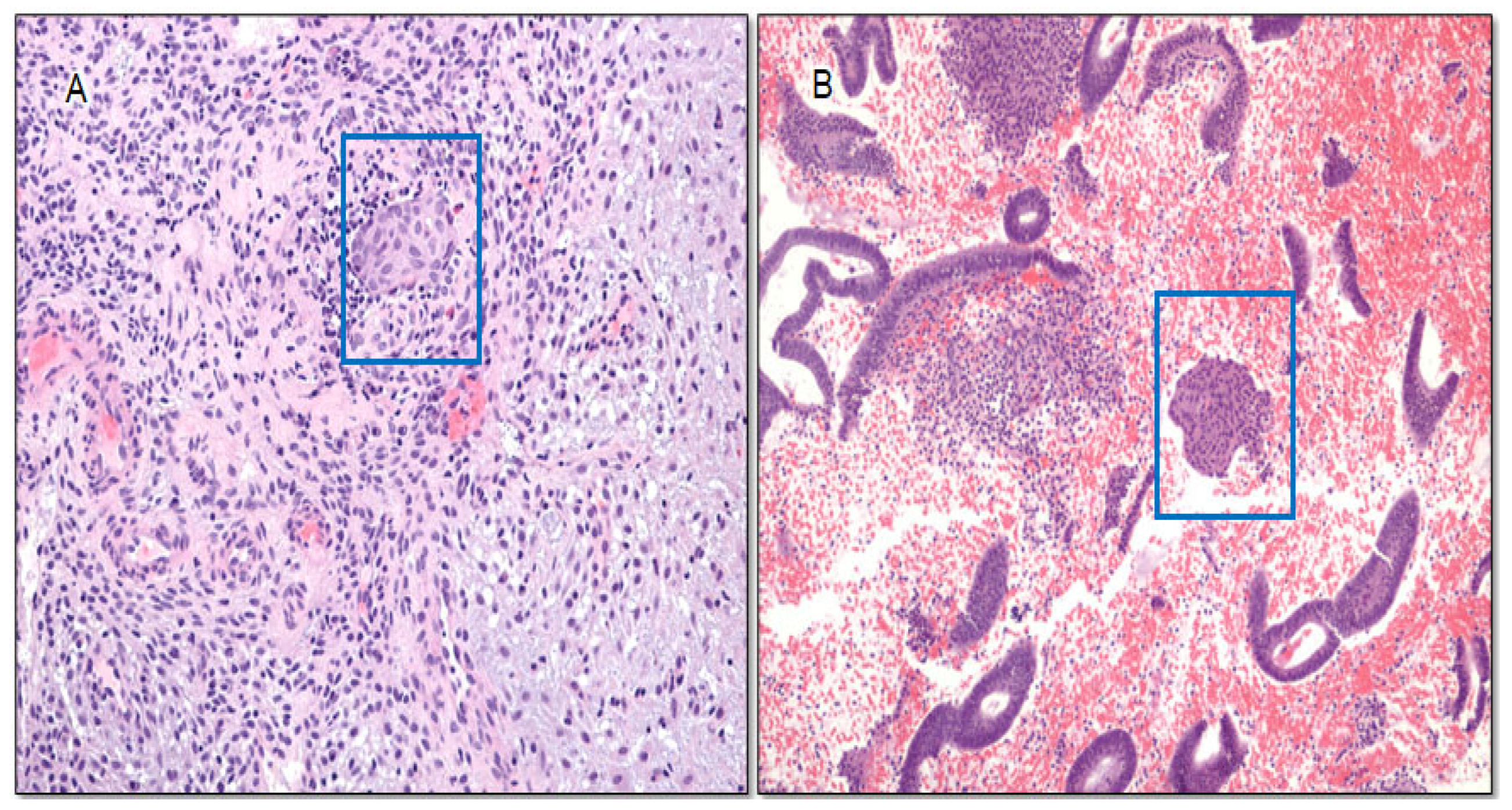 Cancers 16 01159 g007