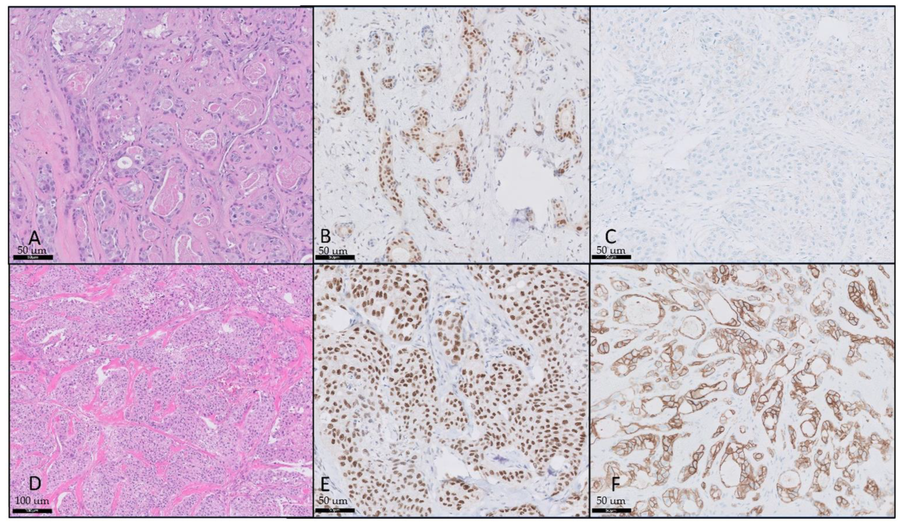 Cancers 16 01204 g001