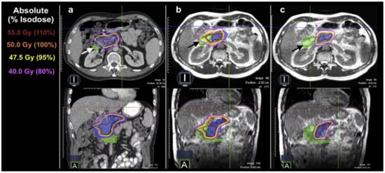 Cancers 16 01206 g004