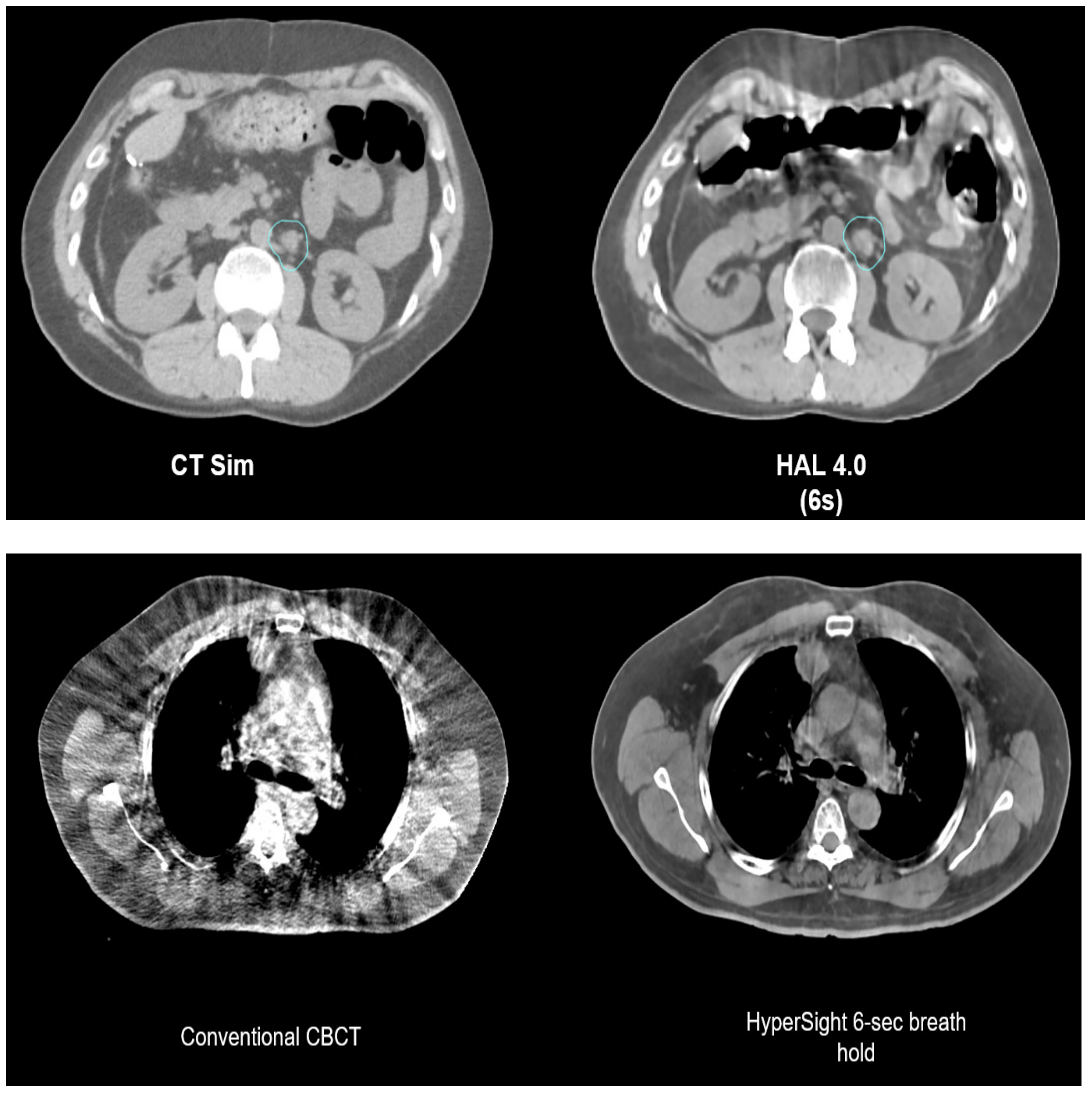 Cancers 16 01206 g005