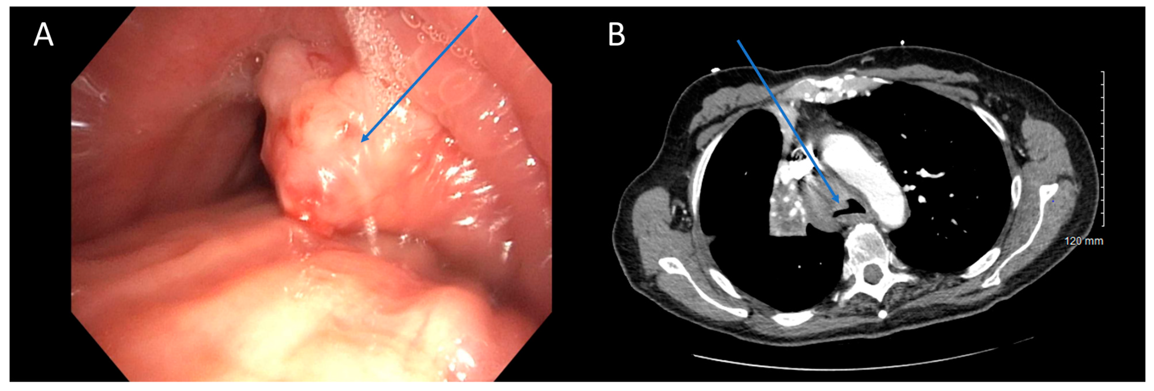 Cancers 16 01258 g001 Cancers 16 01258 g001