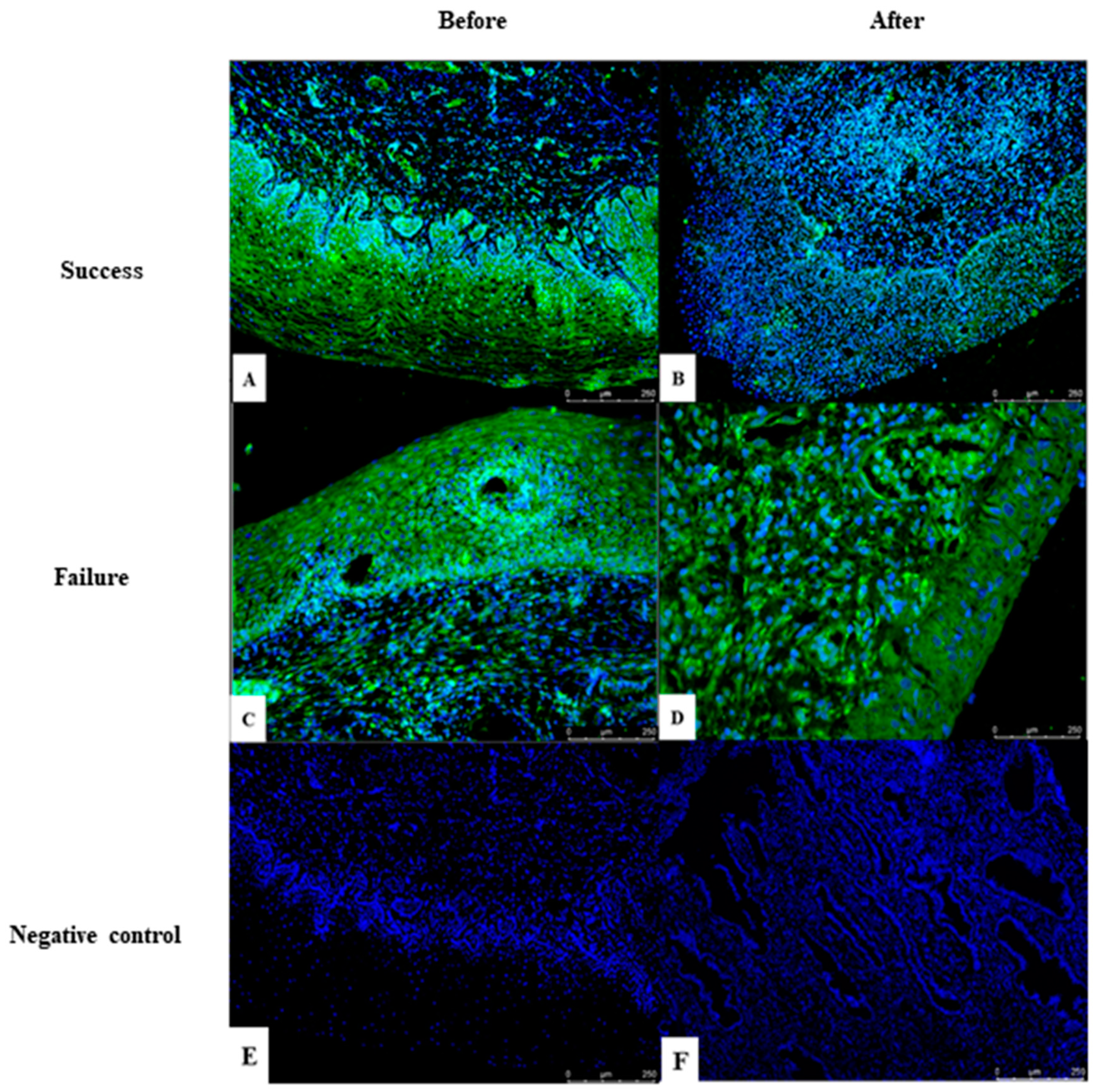 Cancers 16 01272 g006