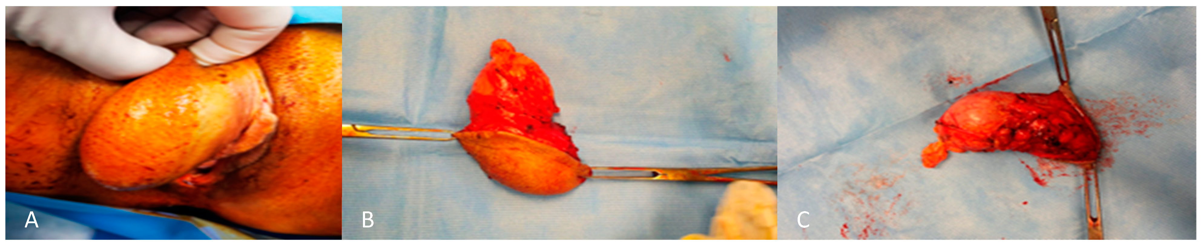 Cancers 16 01375 g002