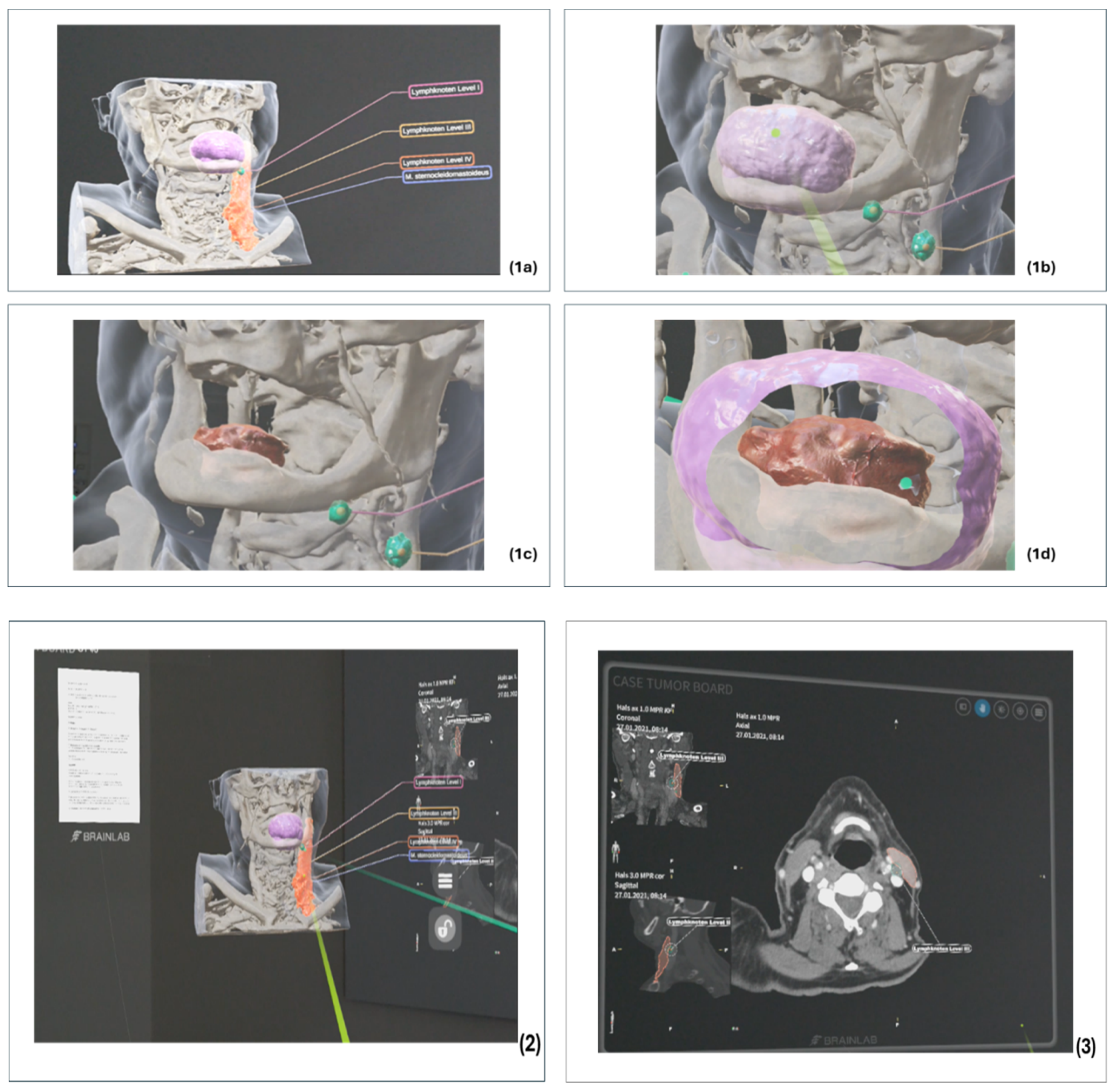 Cancers 16 01392 g006