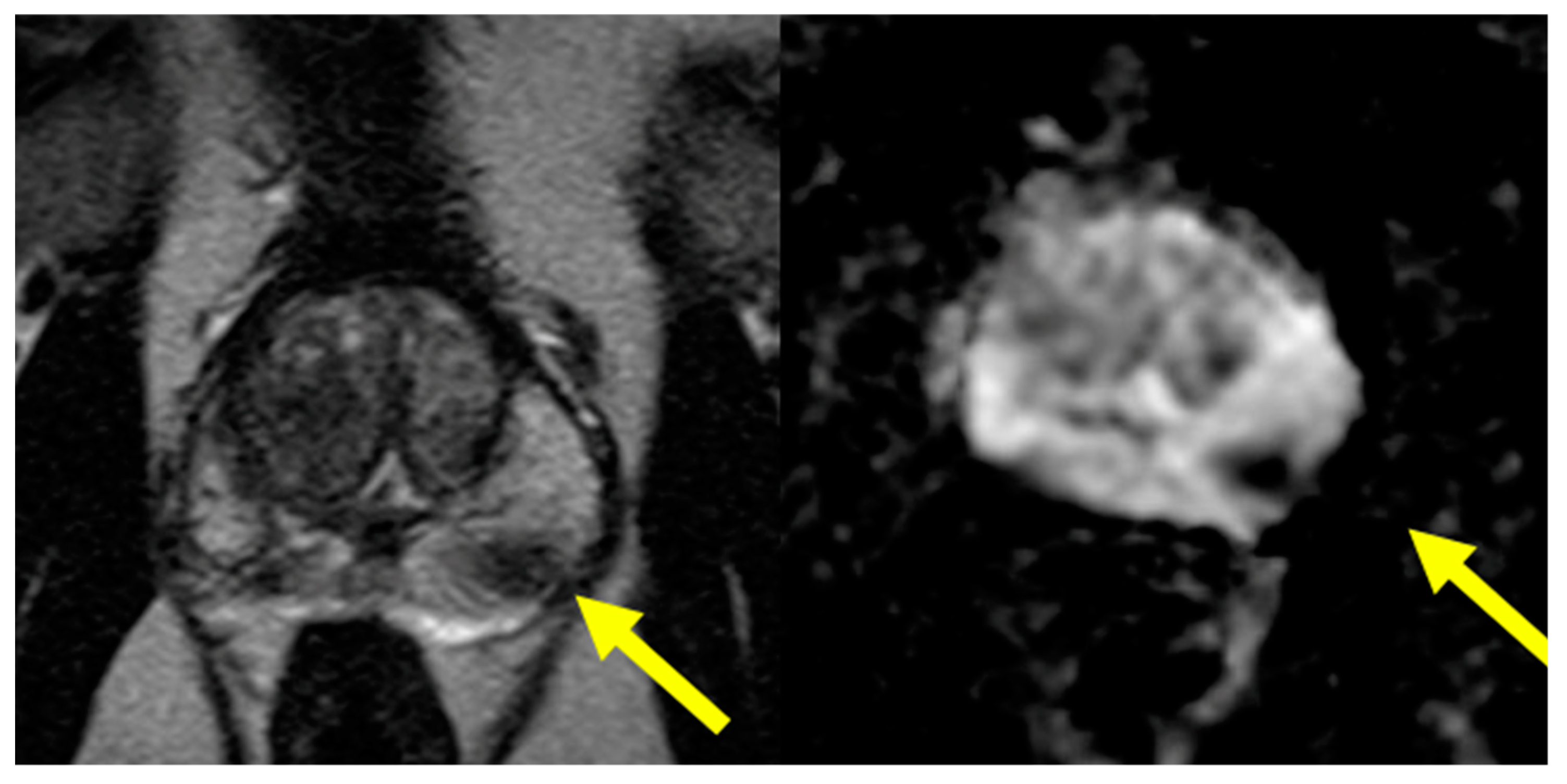 Cancers 16 01424 g001