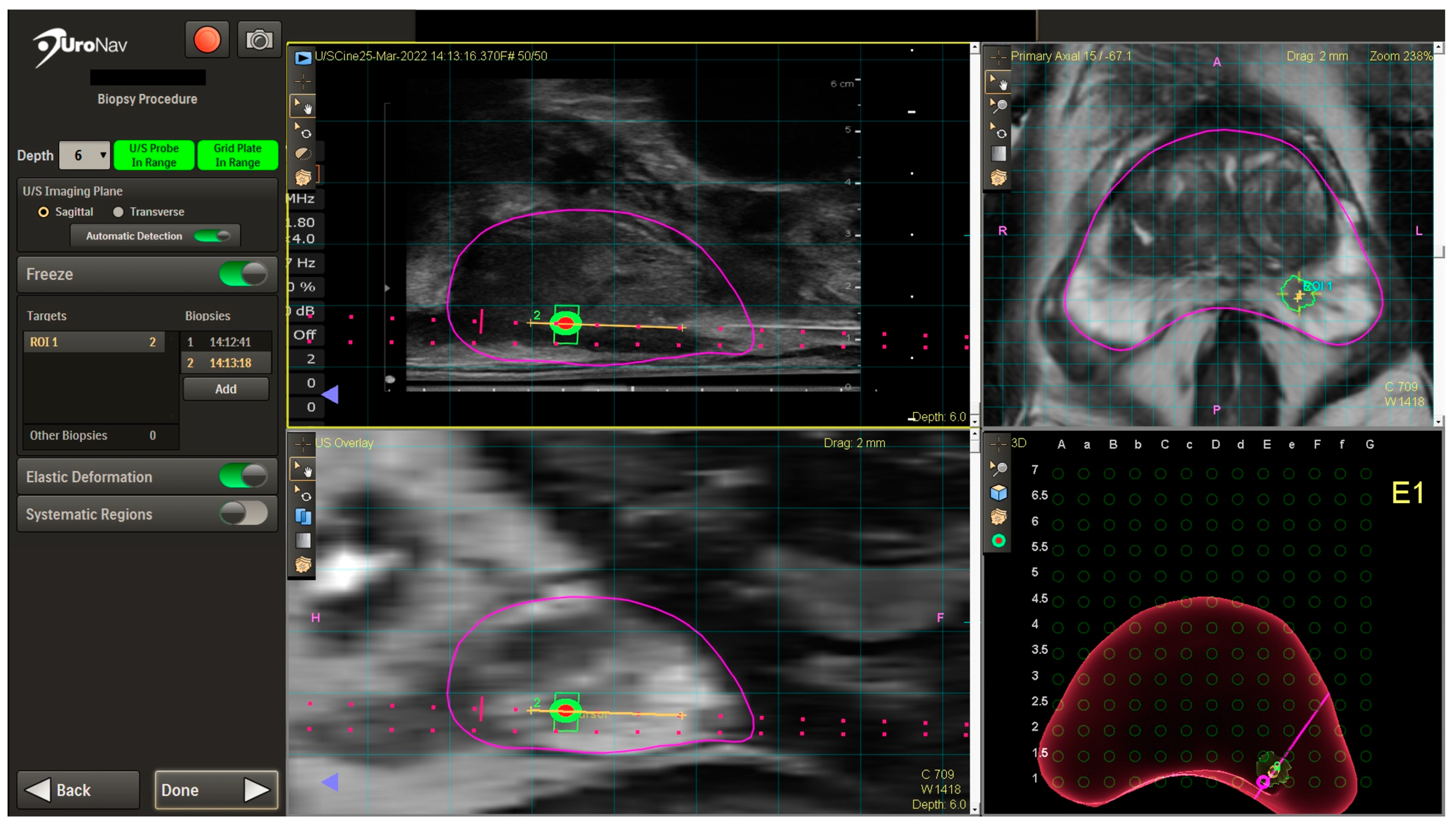 Cancers 16 01424 g002