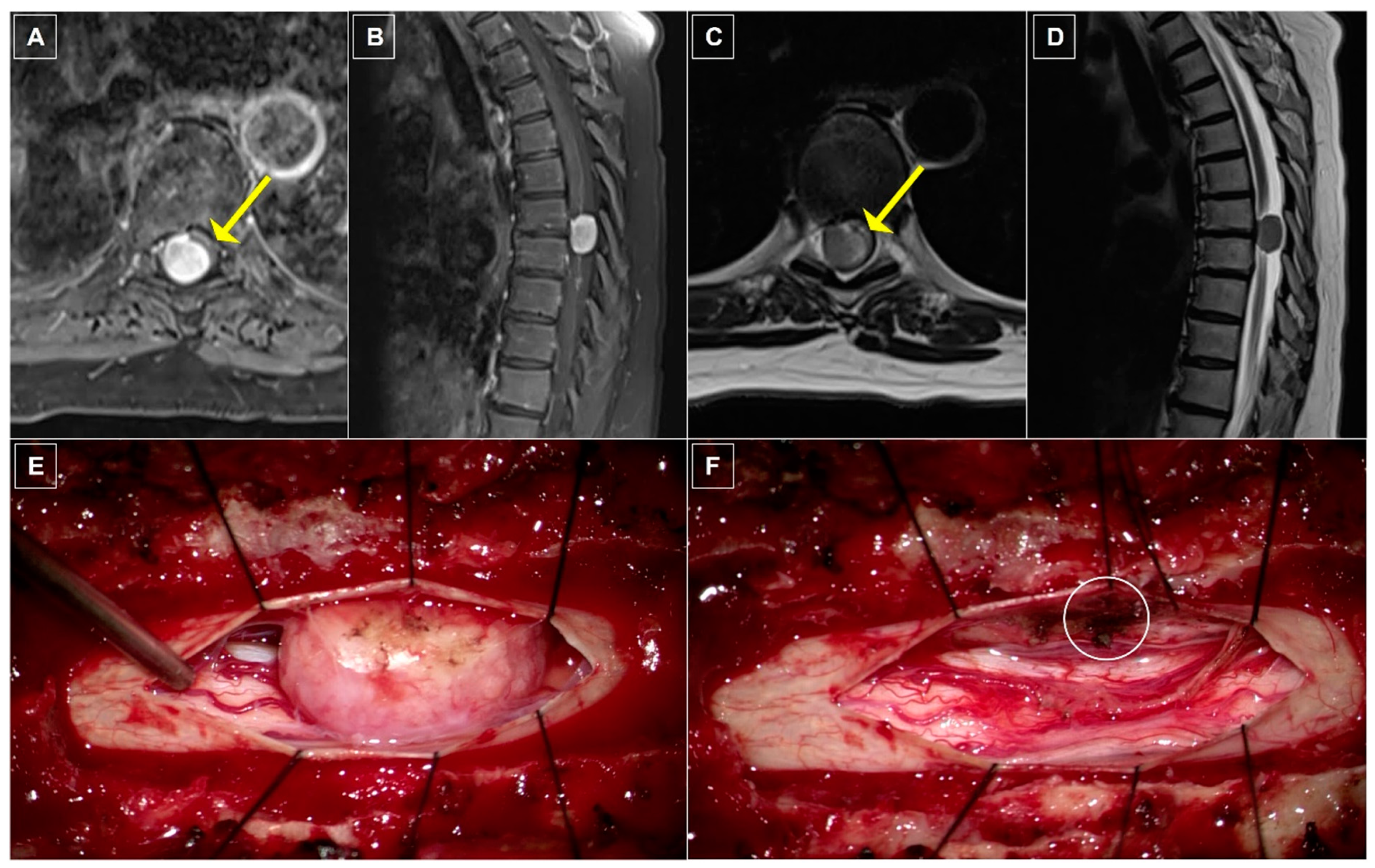 Cancers 16 01426 g001
