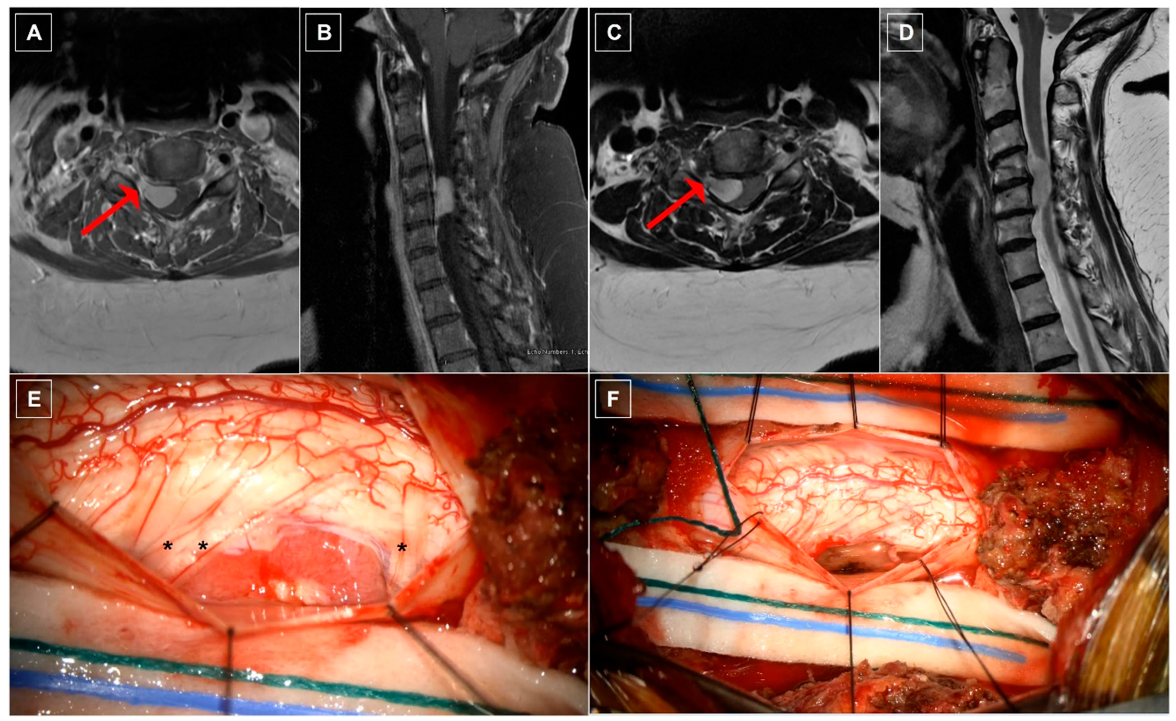 Cancers 16 01426 g002