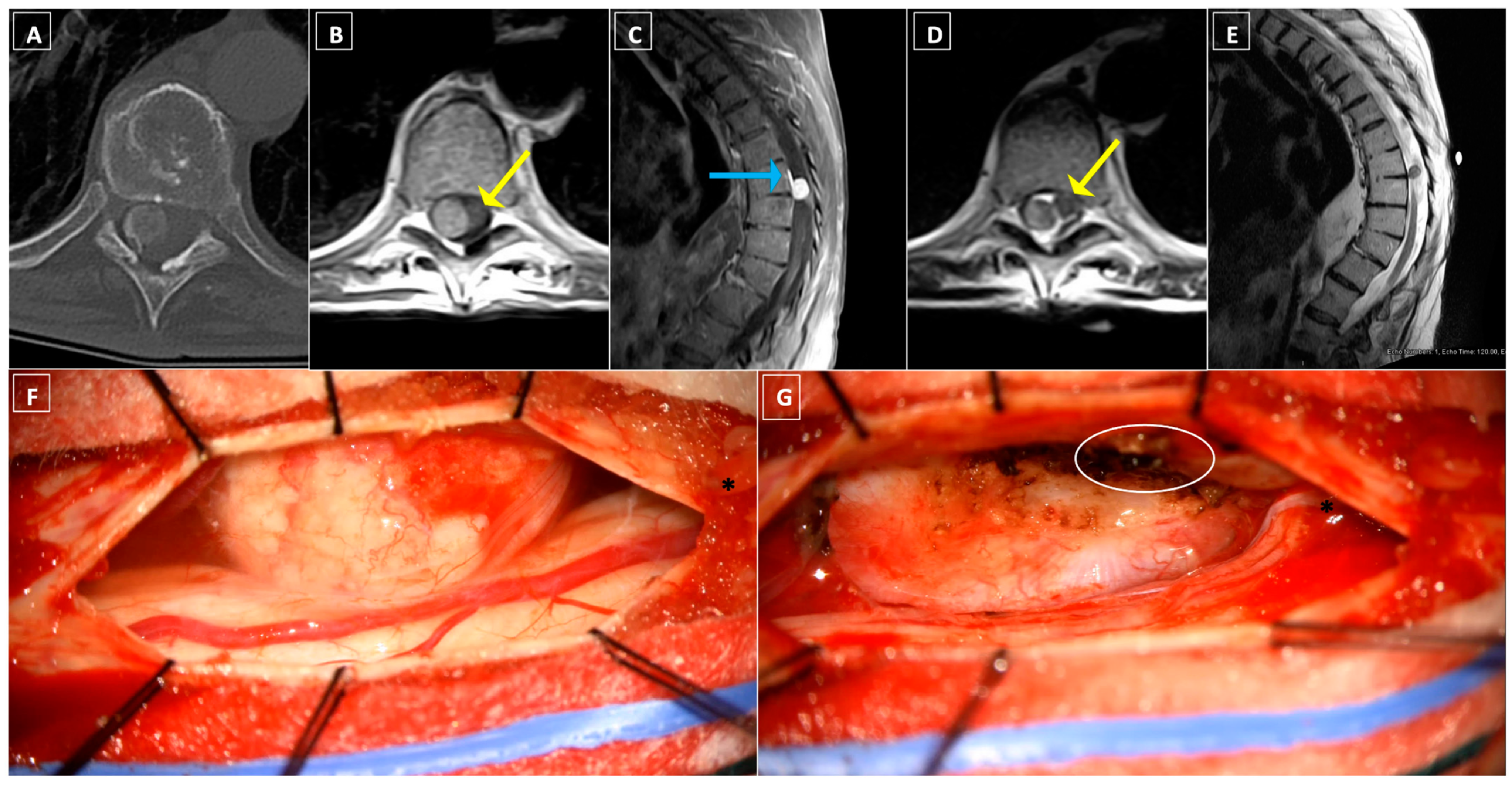 Cancers 16 01426 g003