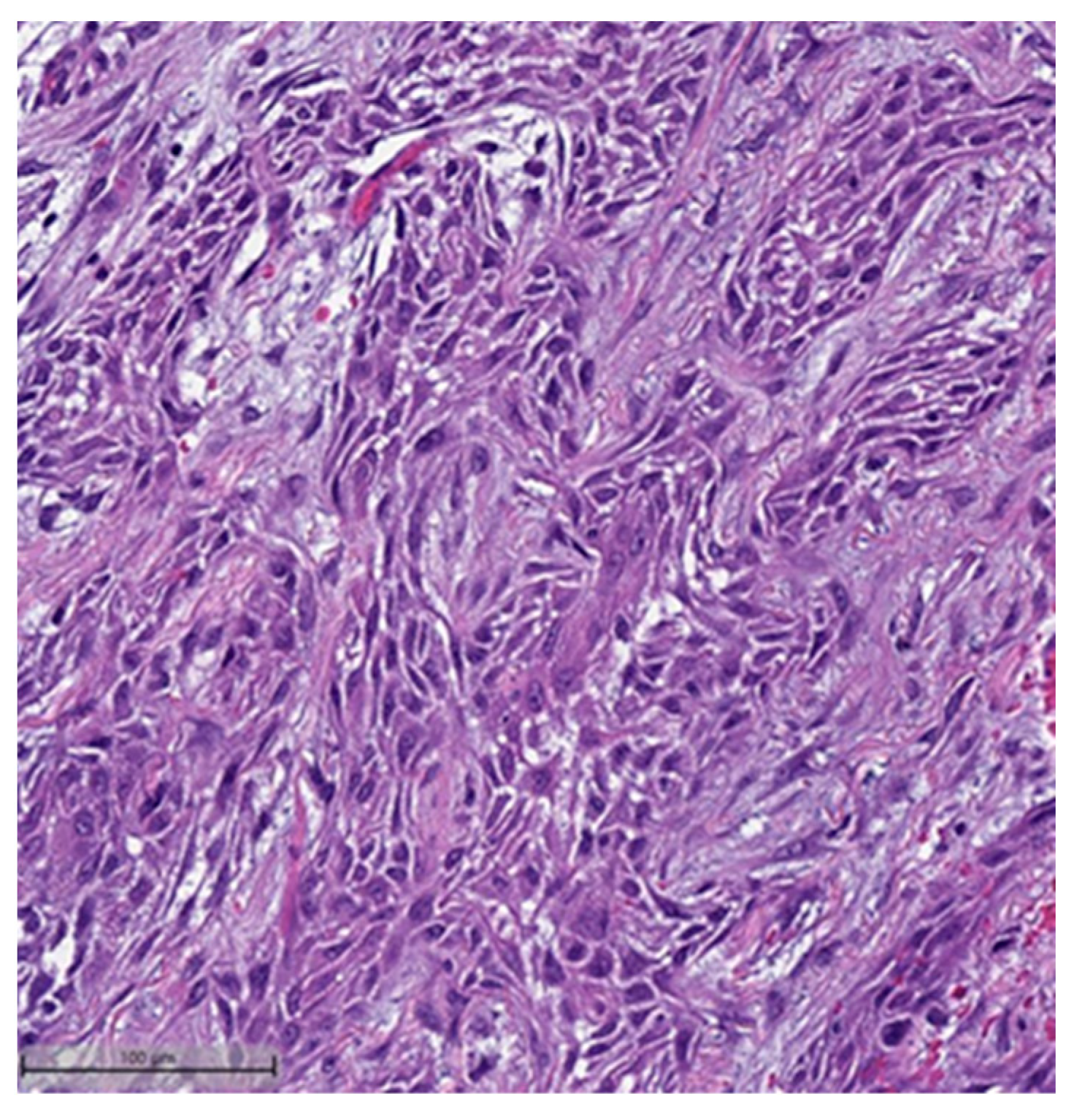 Cancers 16 01433 g001