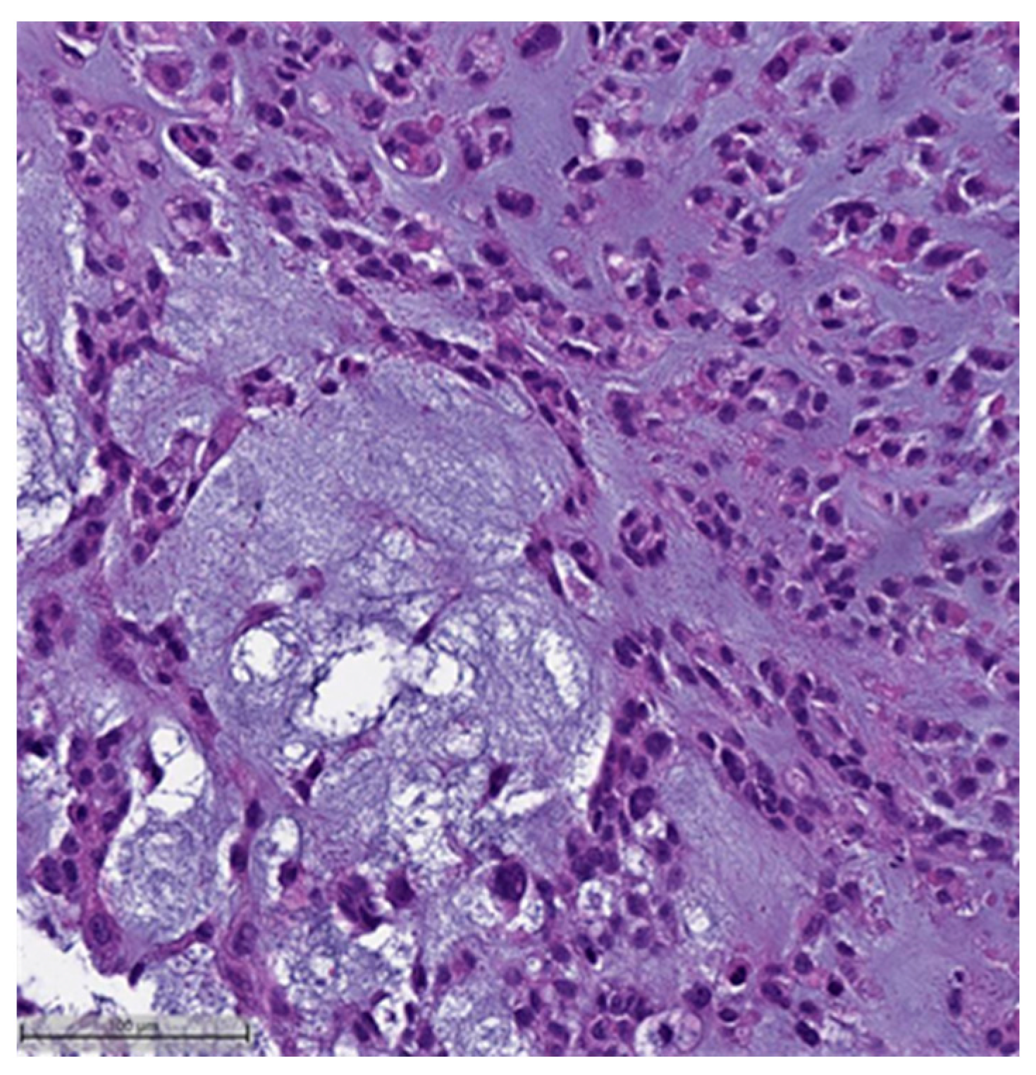 Cancers 16 01433 g006