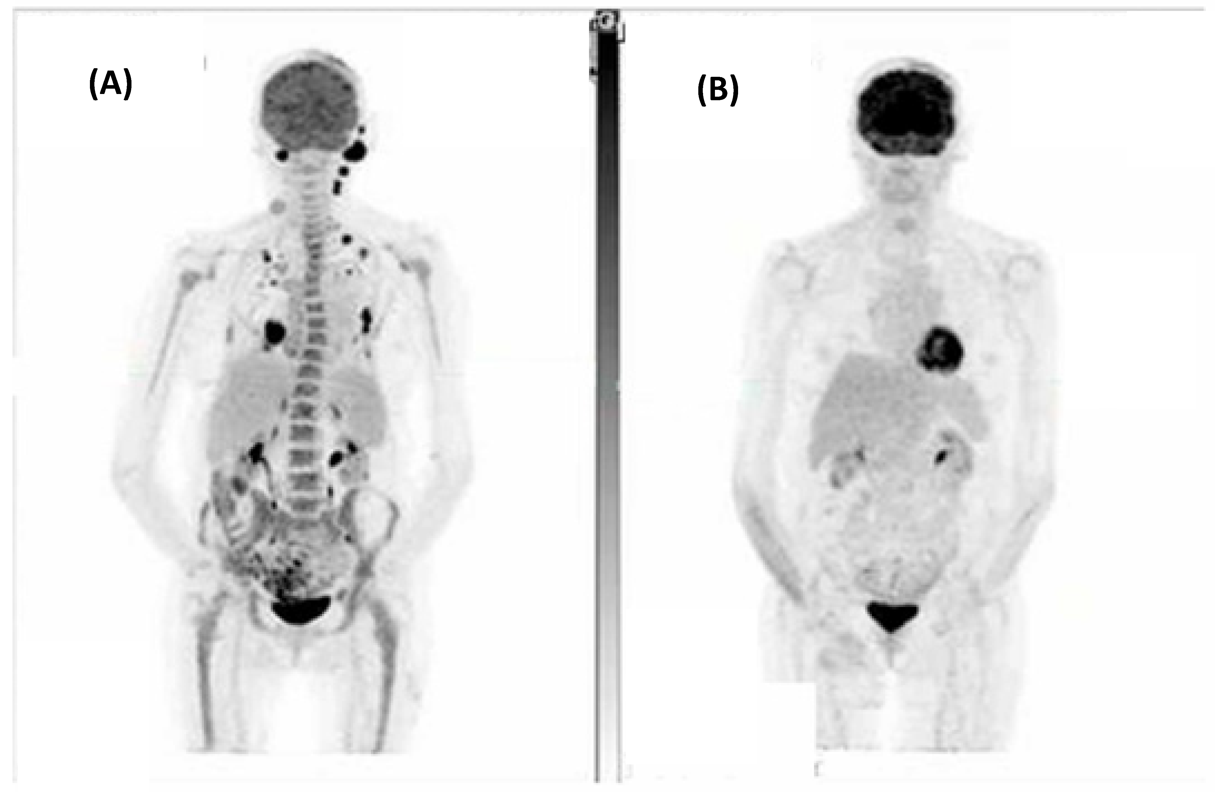 Cancers 16 01452 g001