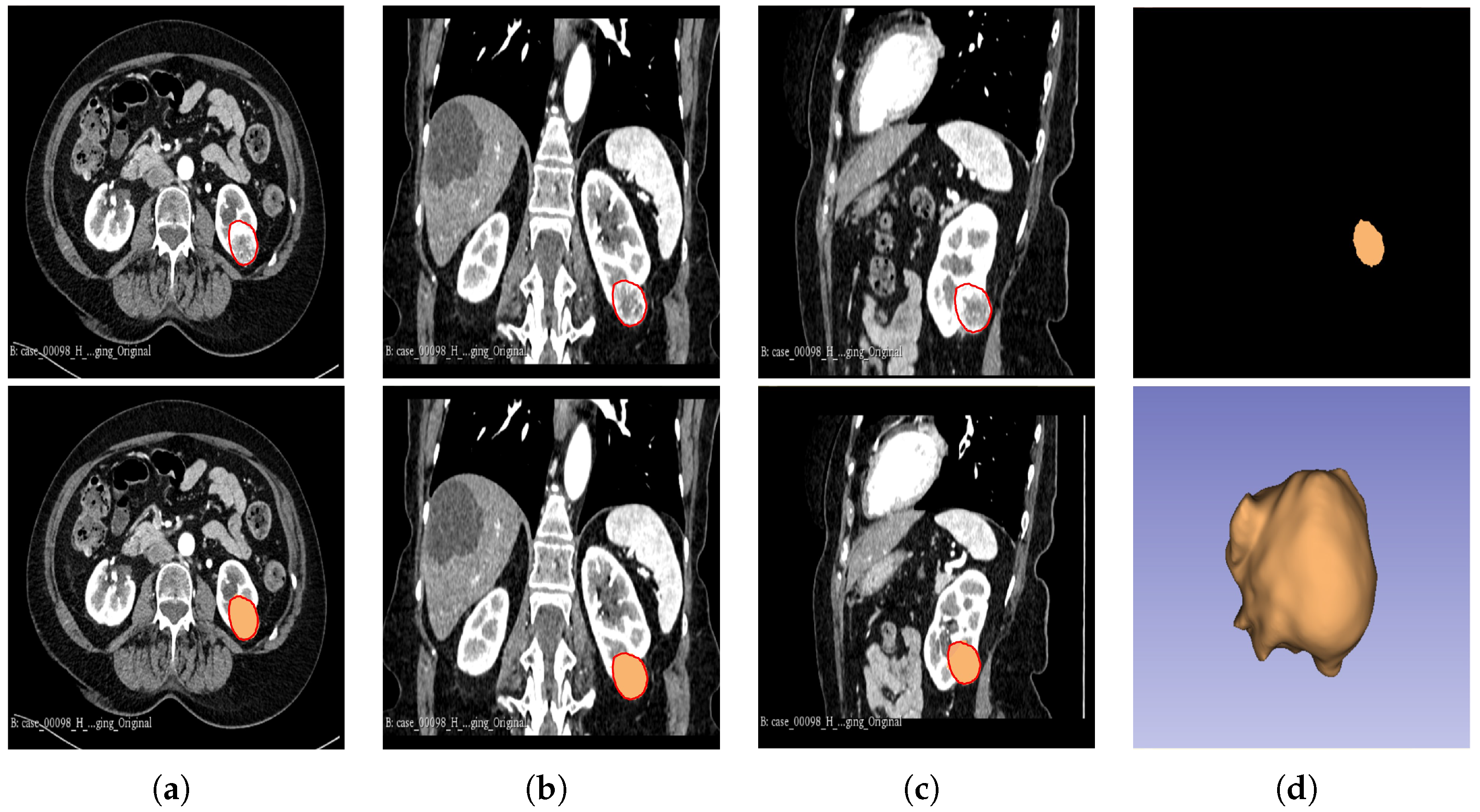 Cancers 16 01454 g002