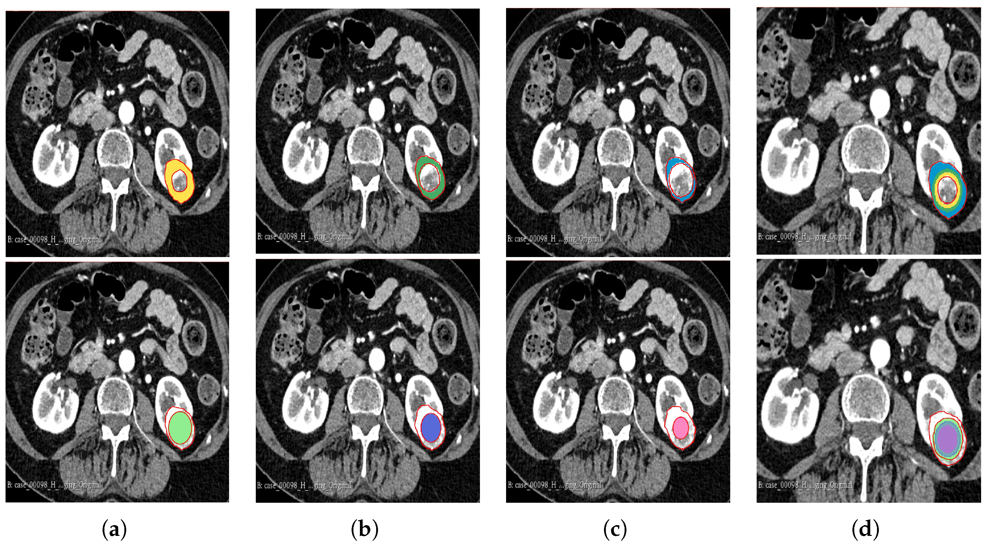 Cancers 16 01454 g003