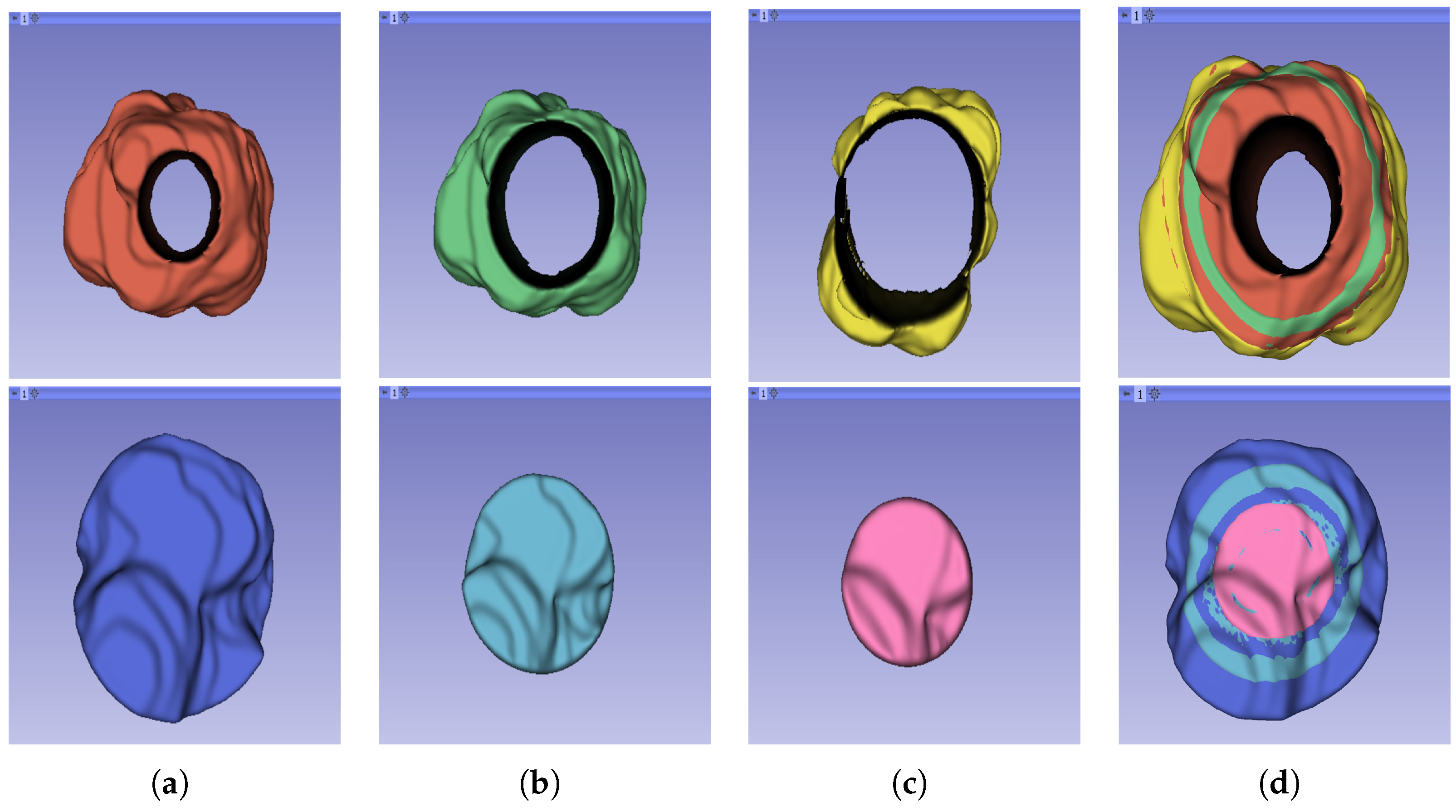 Cancers 16 01454 g004