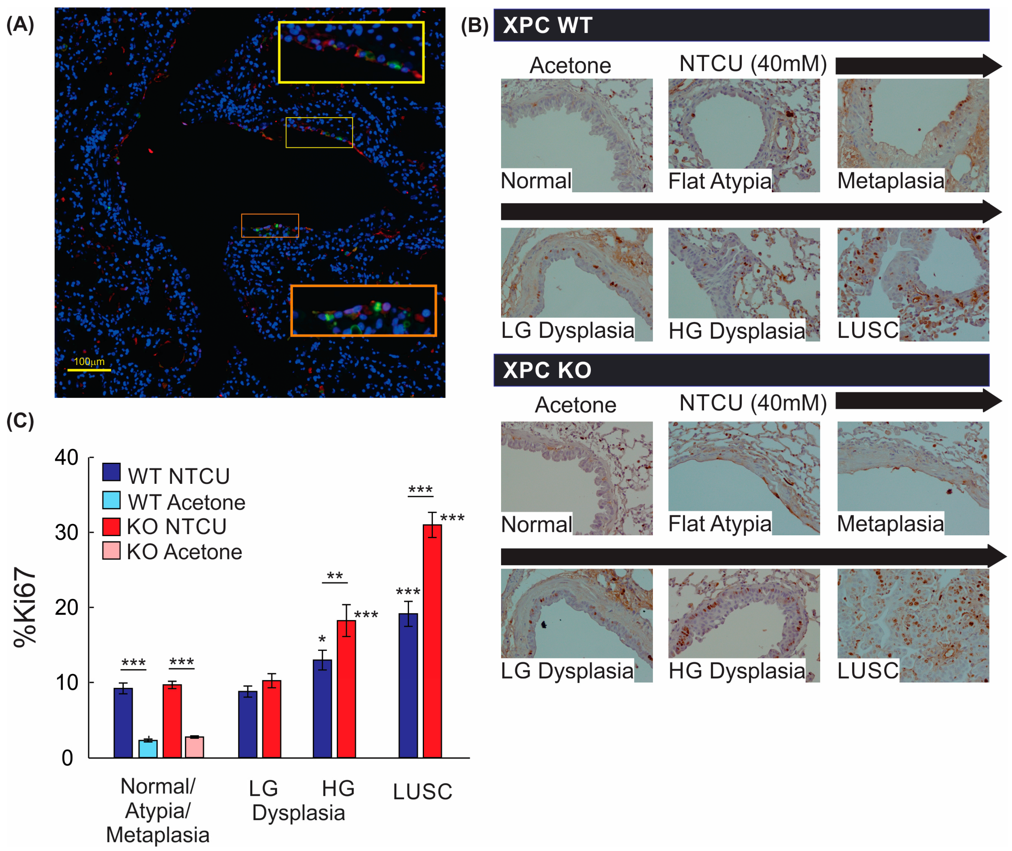 Cancers 16 01495 g005