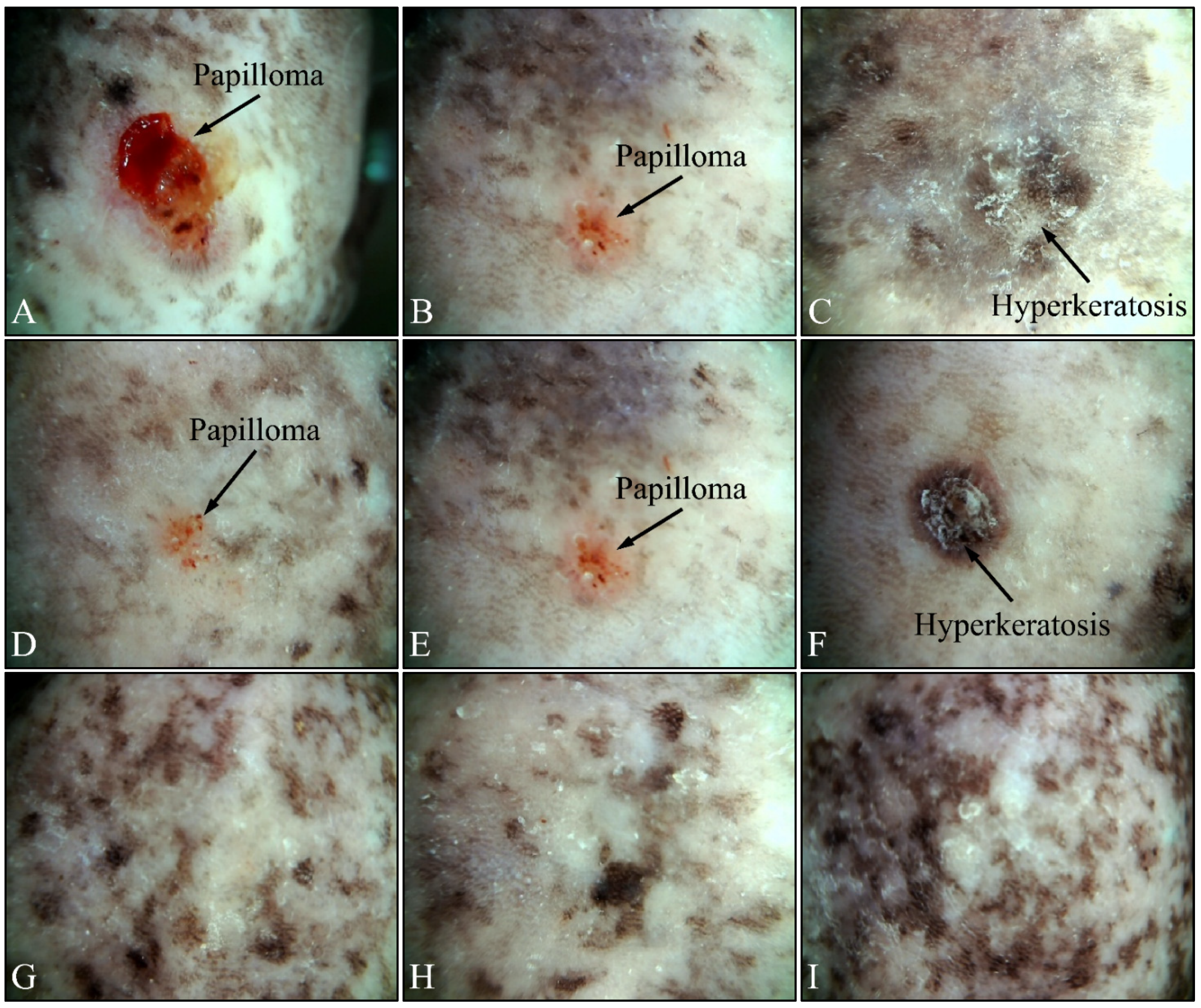 Cancers 16 01507 g012