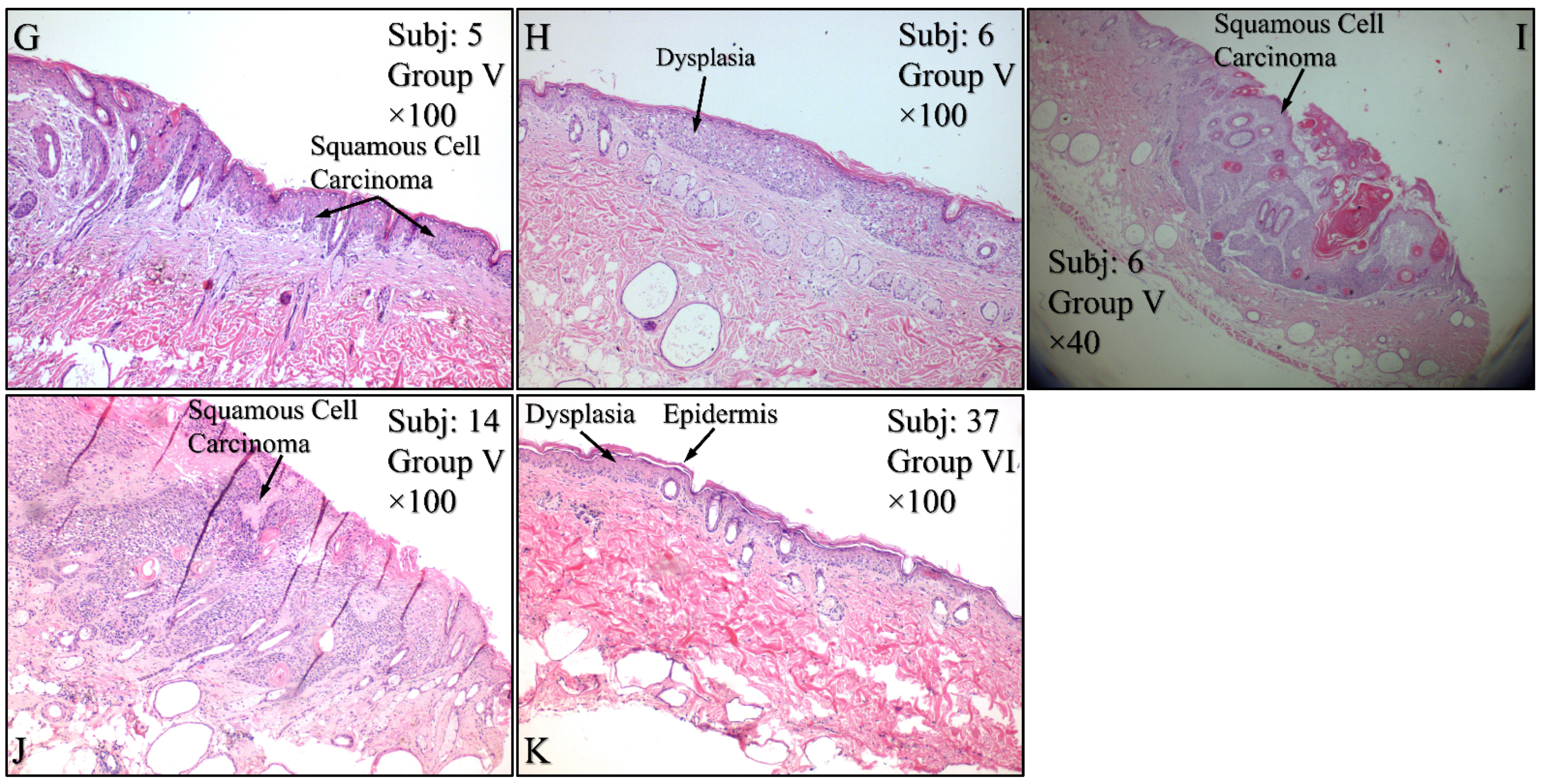 Cancers 16 01507 g015b