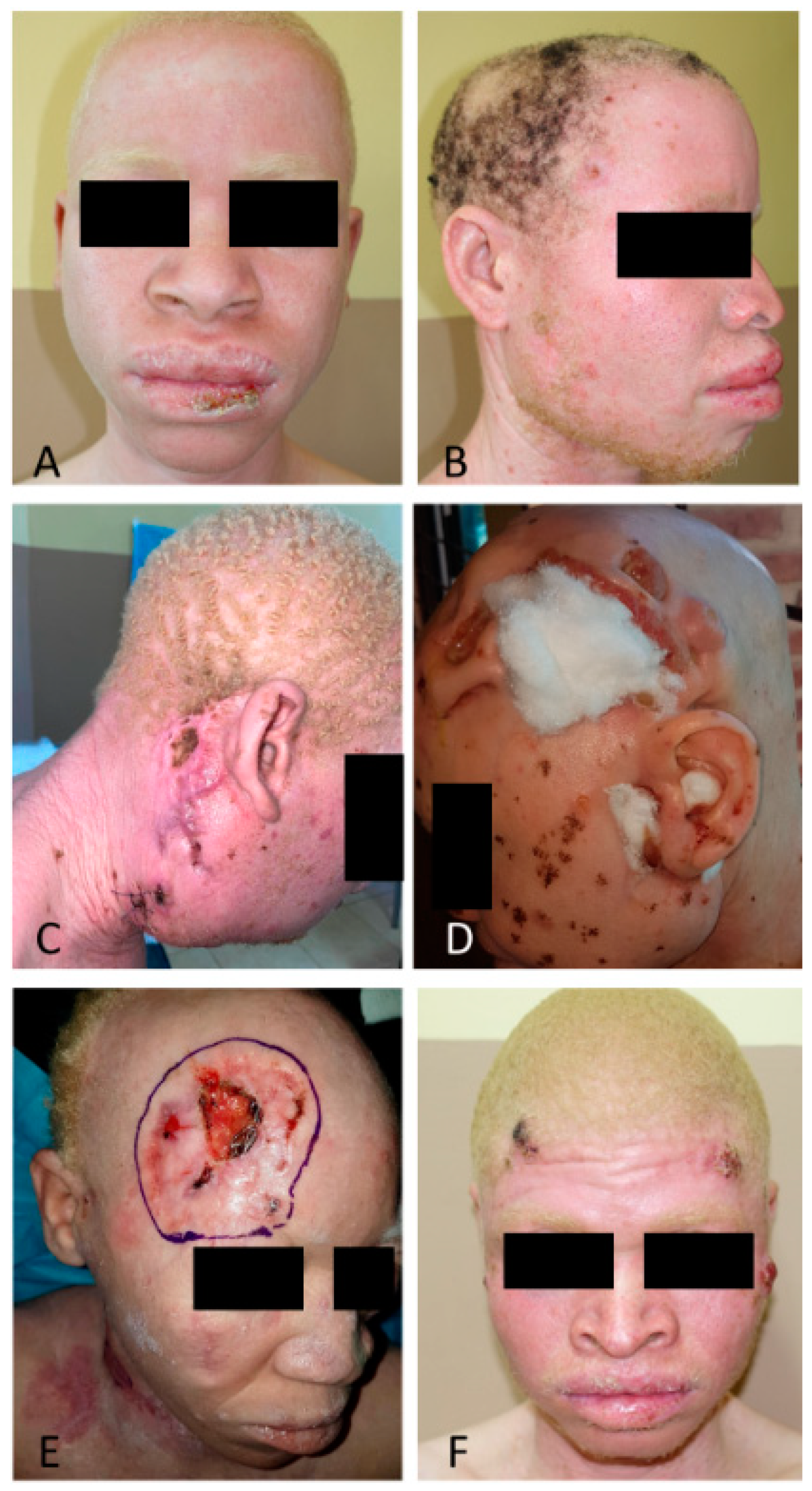 Cancers 16 01522 g001