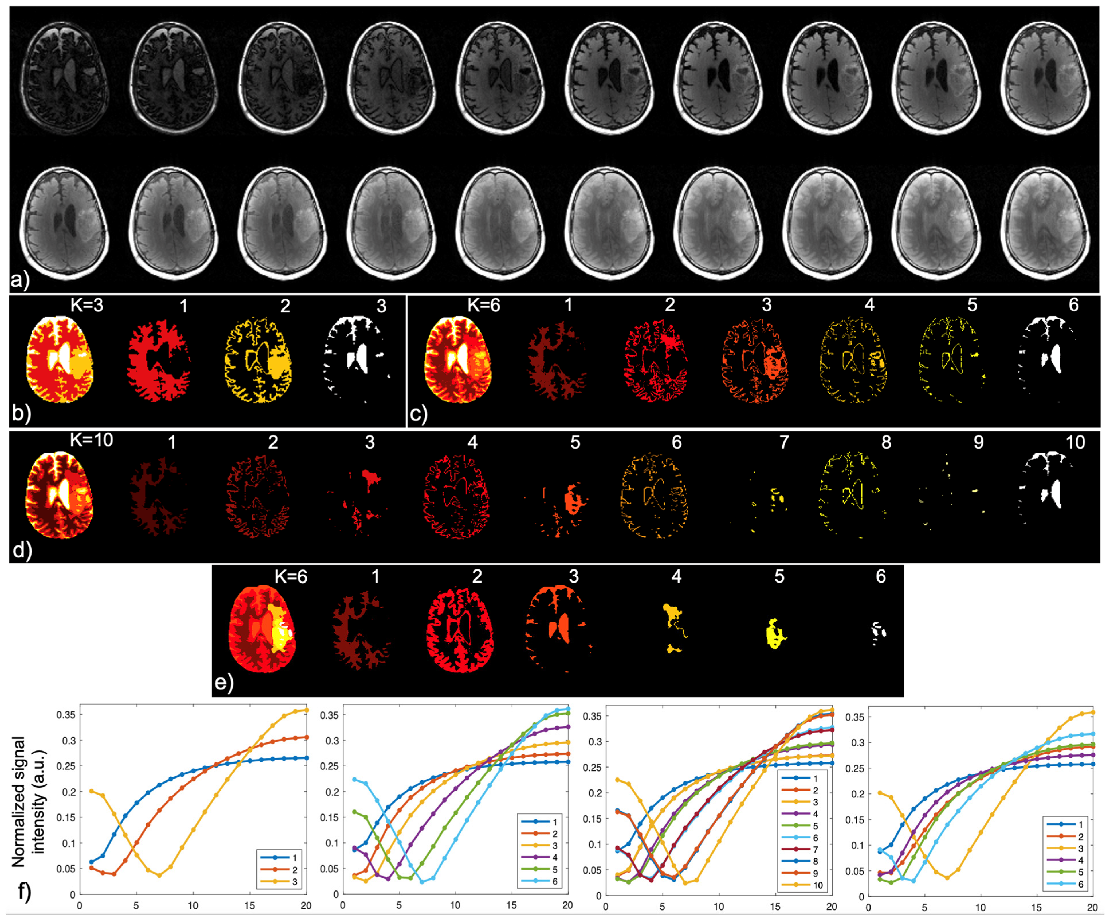 Cancers 16 01524 g002