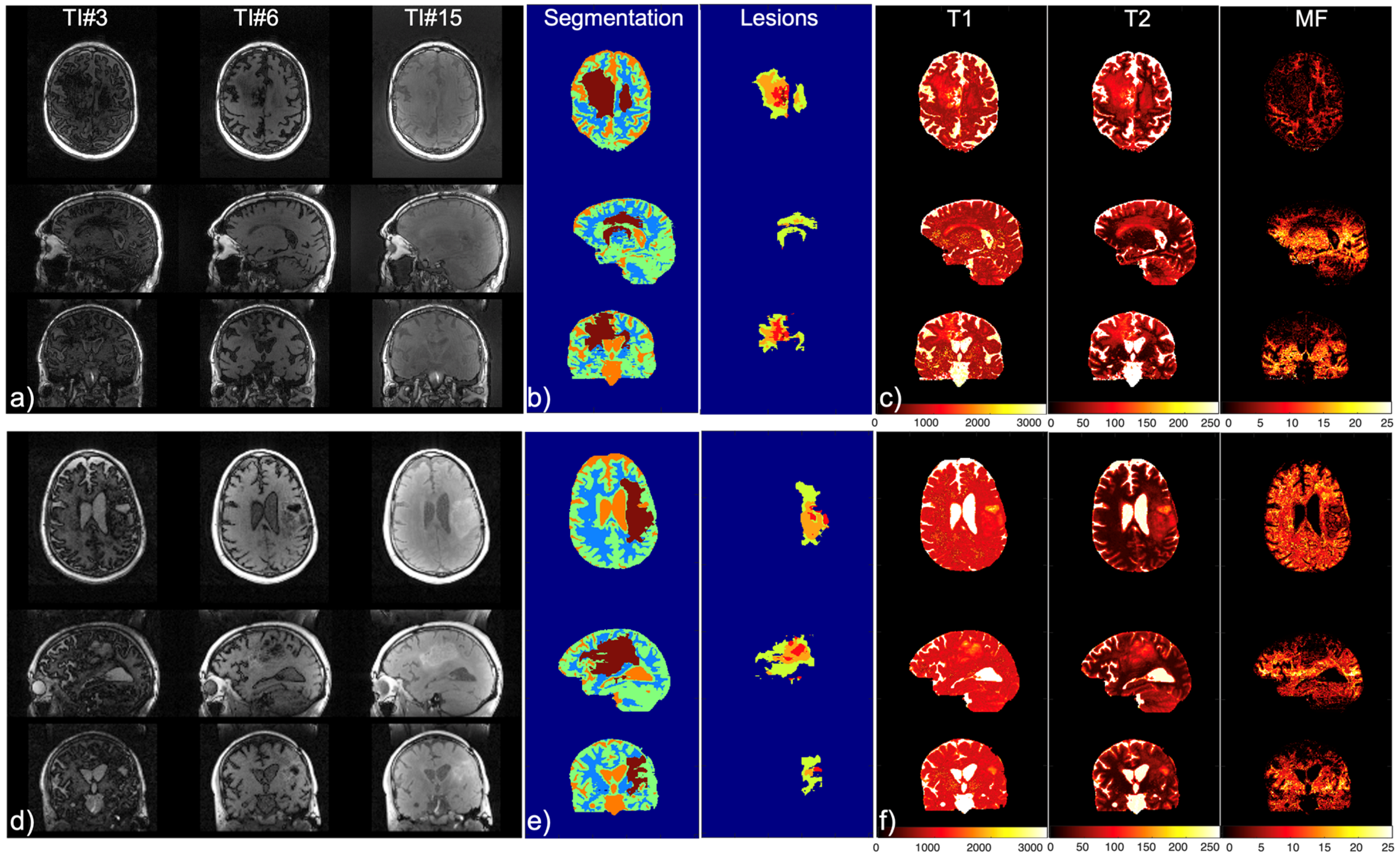Cancers 16 01524 g004