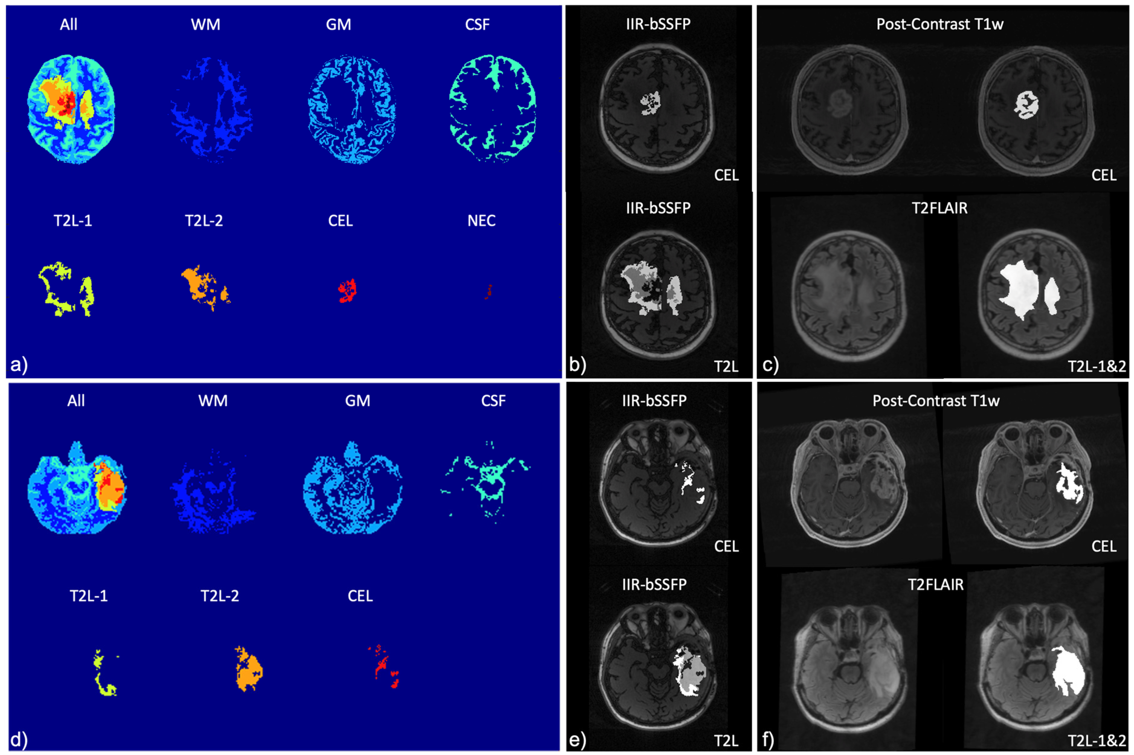 Cancers 16 01524 g005