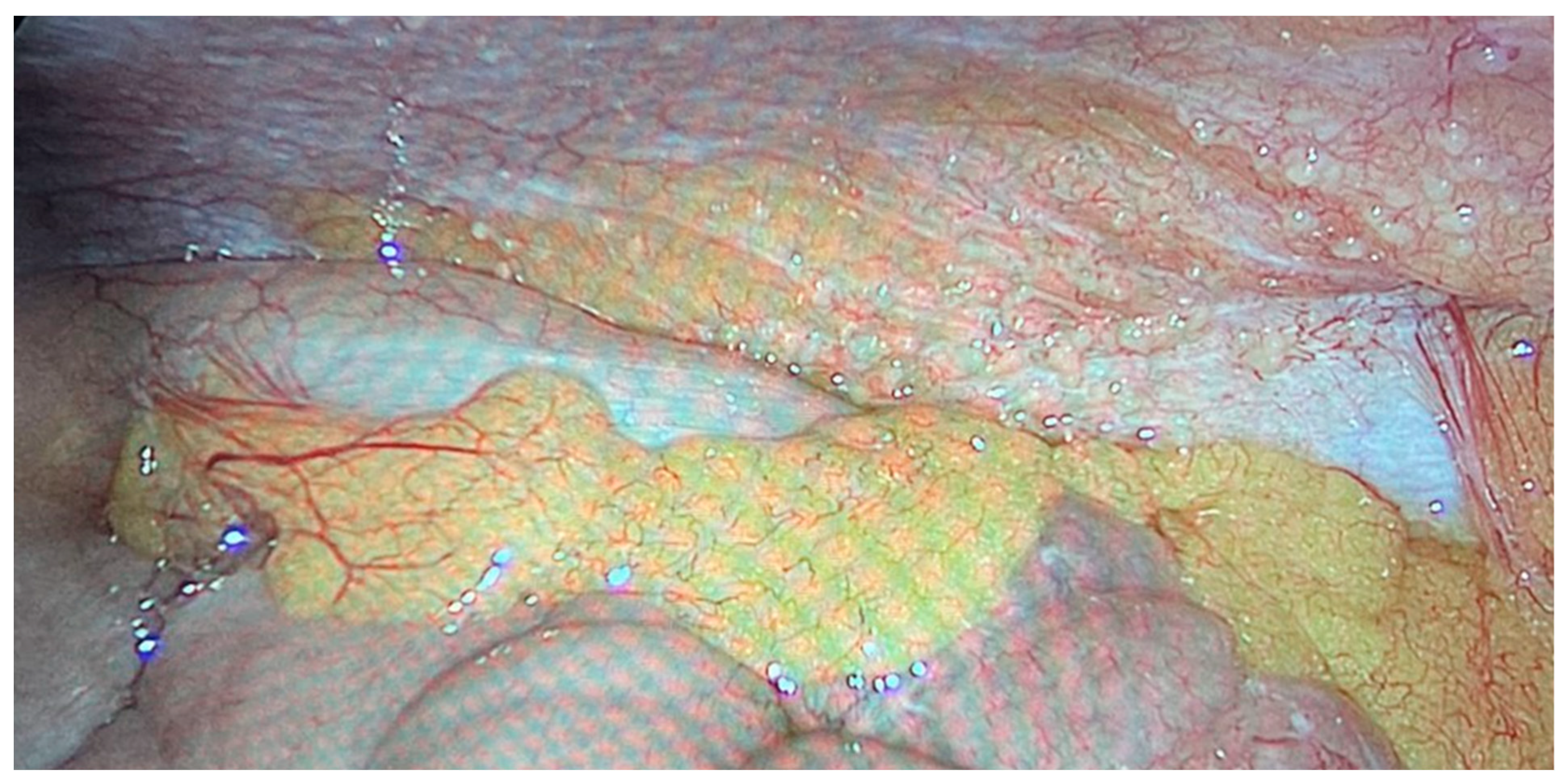 Cancers 16 01559 g004