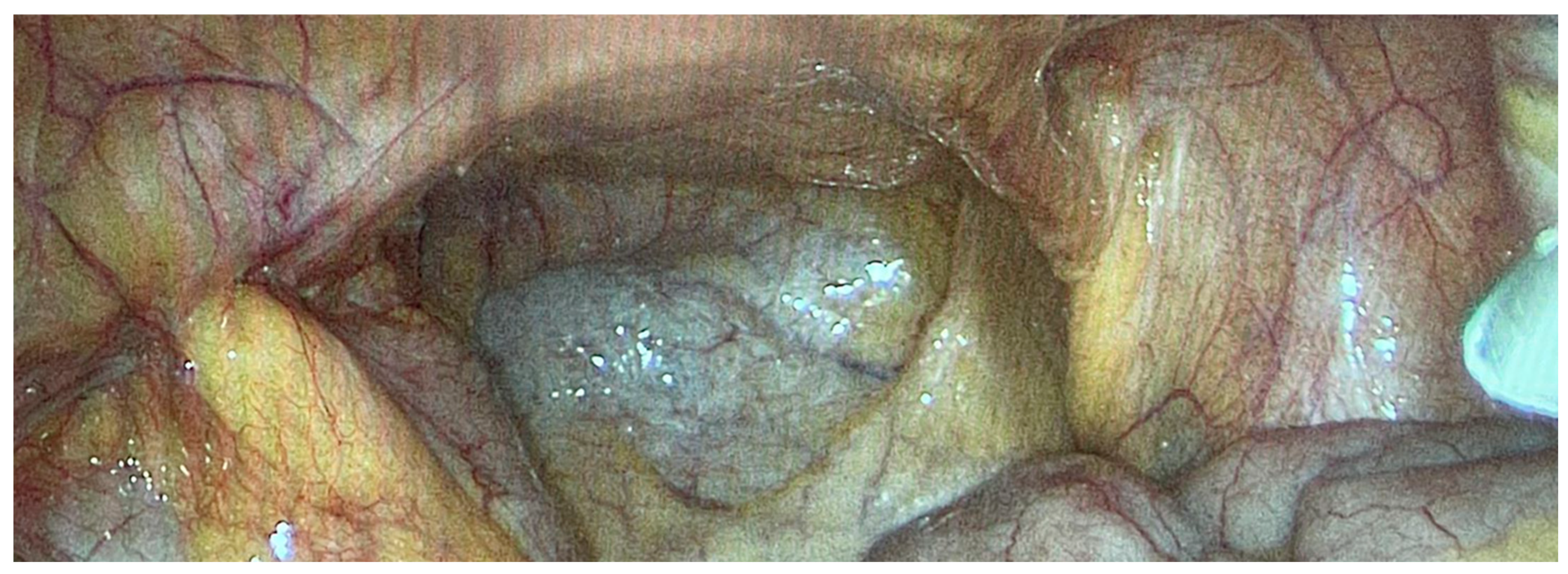 Cancers 16 01559 g005